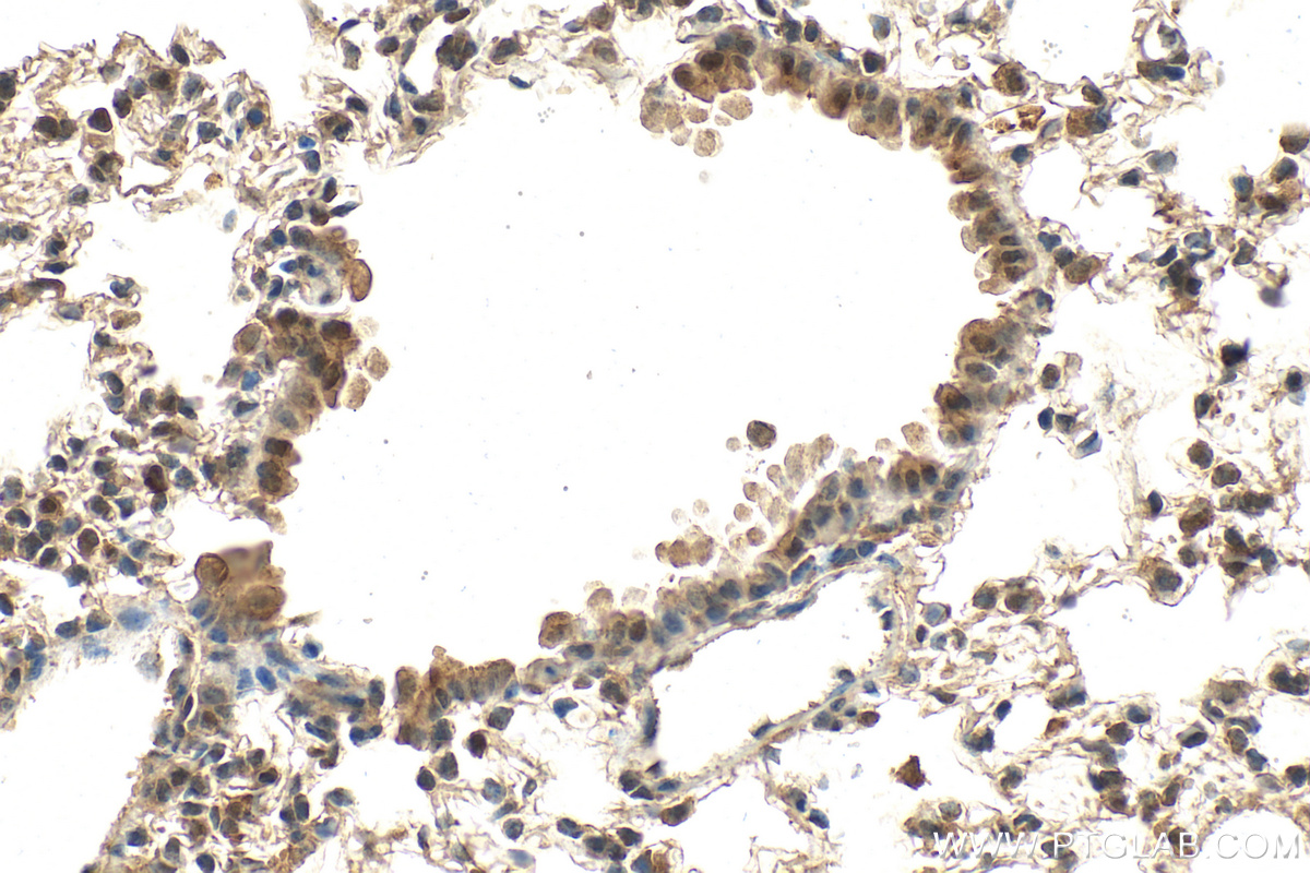 Immunohistochemistry (IHC) staining of mouse lung tissue using AKT Monoclonal antibody (60203-2-Ig)