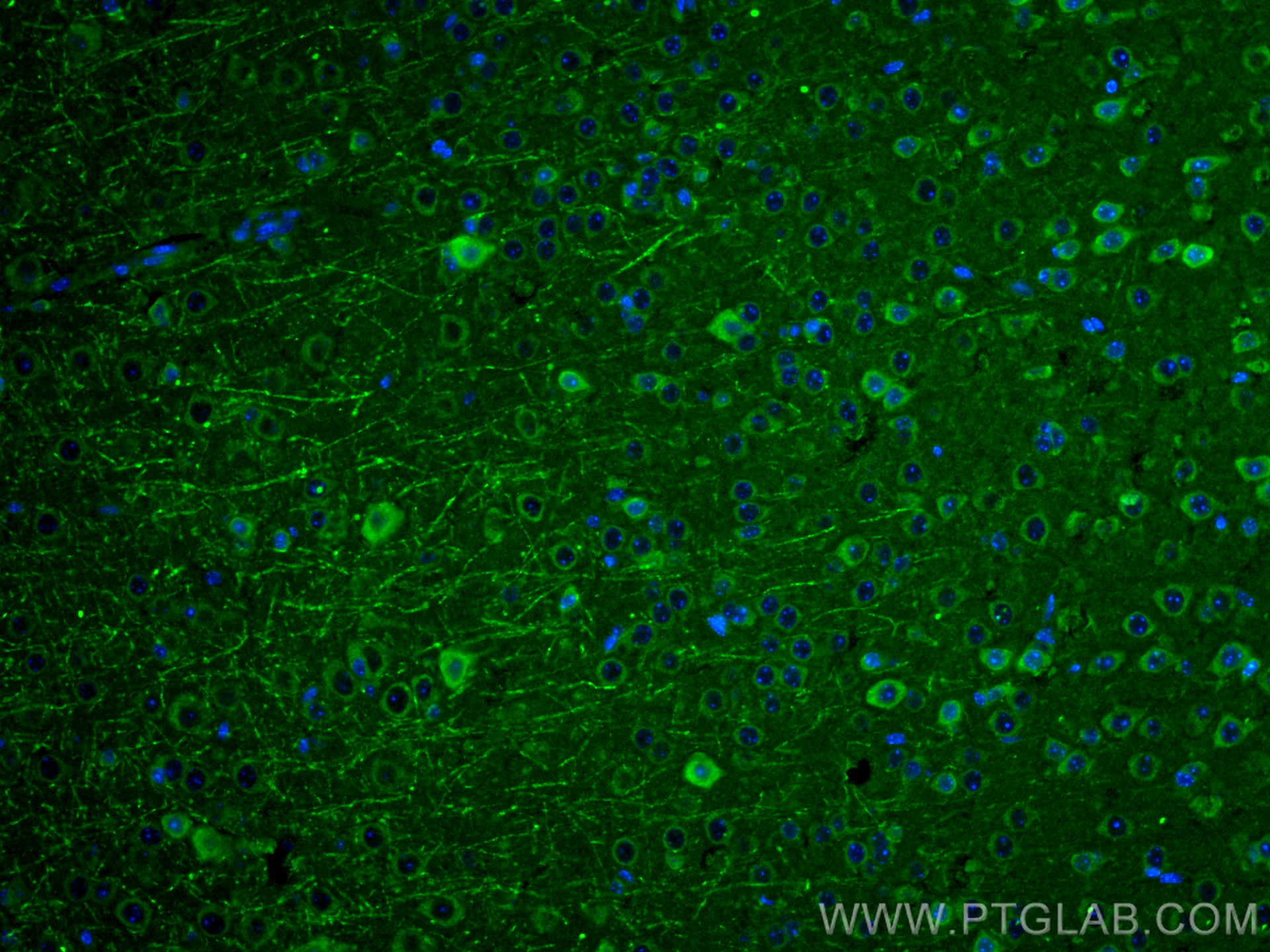 Immunofluorescence (IF) / fluorescent staining of mouse brain tissue using ALAS1 Polyclonal antibody (16200-1-AP)