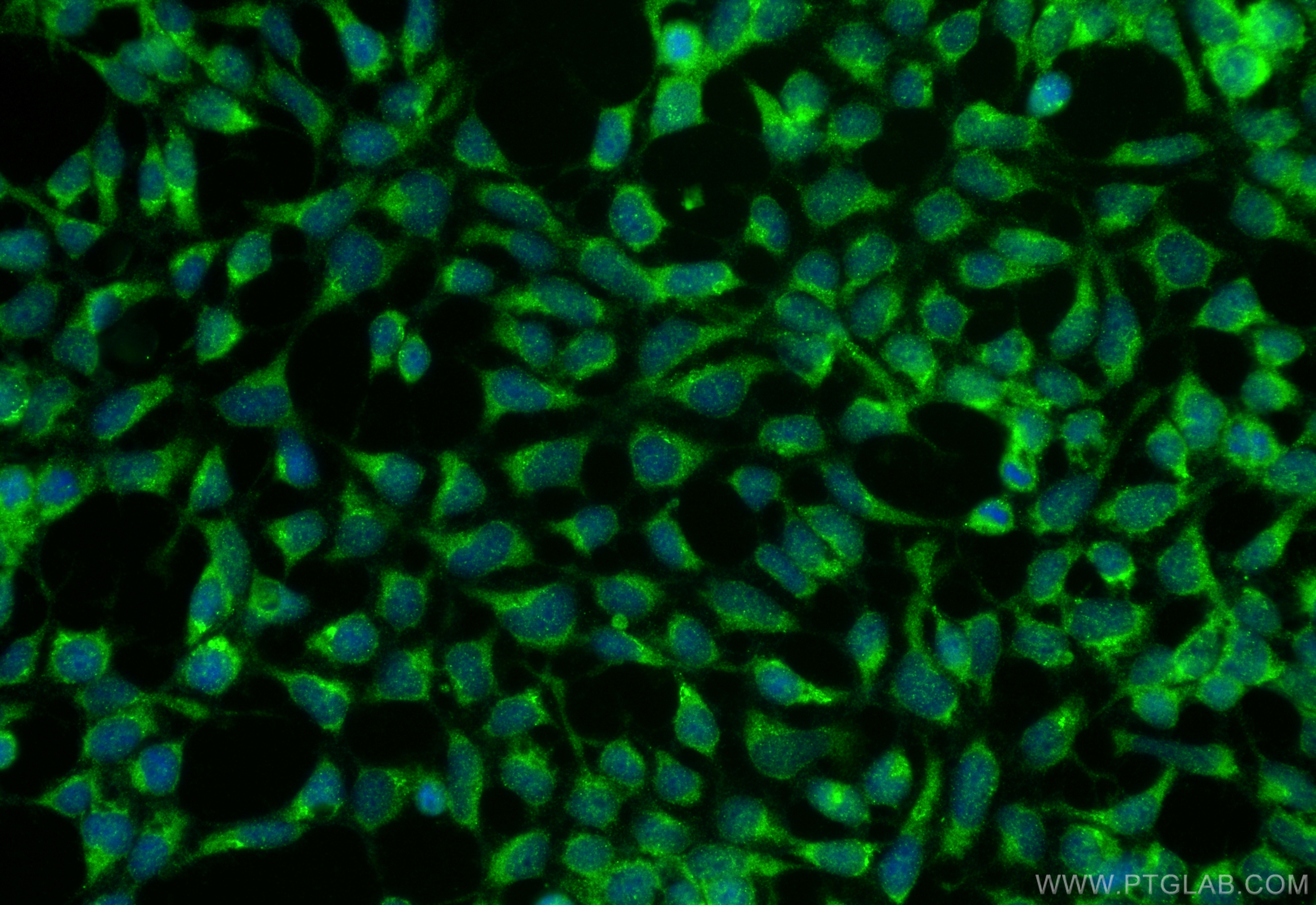 Immunofluorescence (IF) / fluorescent staining of HEK-293 cells using ALAS2 Polyclonal antibody (30539-1-AP)