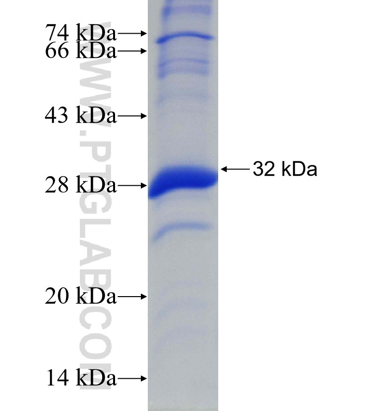 ALAS2 fusion protein Ag30308 SDS-PAGE