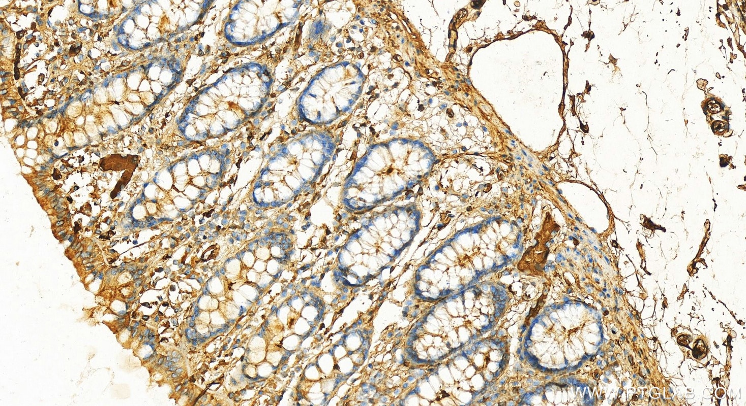 Immunohistochemistry (IHC) staining of human colon tissue using Albumin Polyclonal antibody (16475-1-AP)