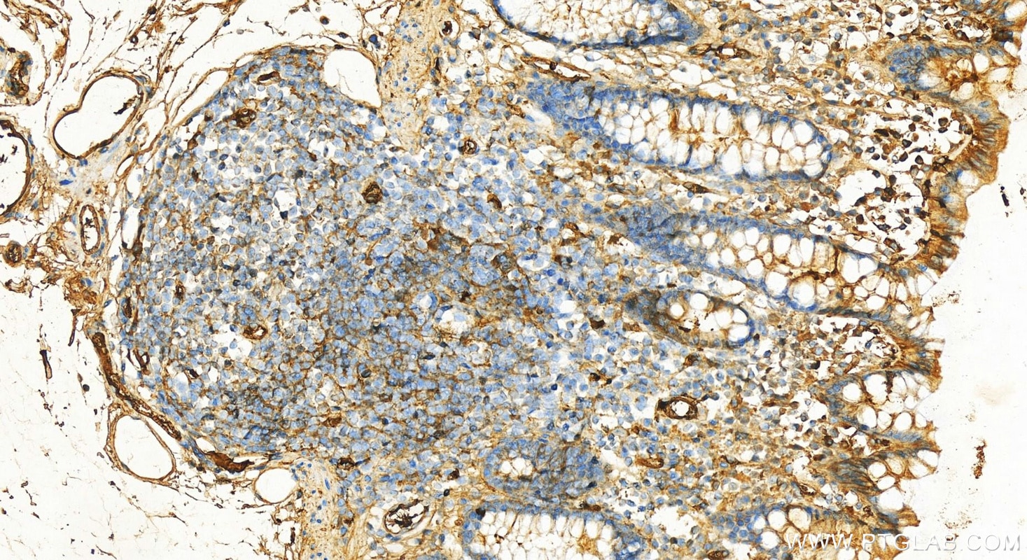 Immunohistochemistry (IHC) staining of human colon tissue using Albumin Polyclonal antibody (16475-1-AP)