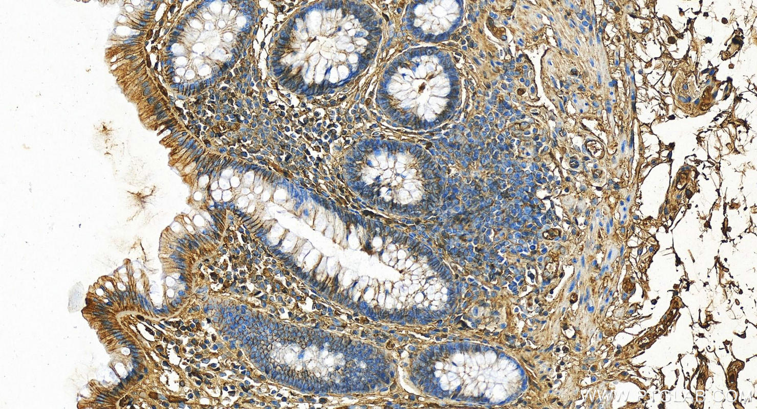 Immunohistochemistry (IHC) staining of human normal colon using Albumin Polyclonal antibody (16475-1-AP)