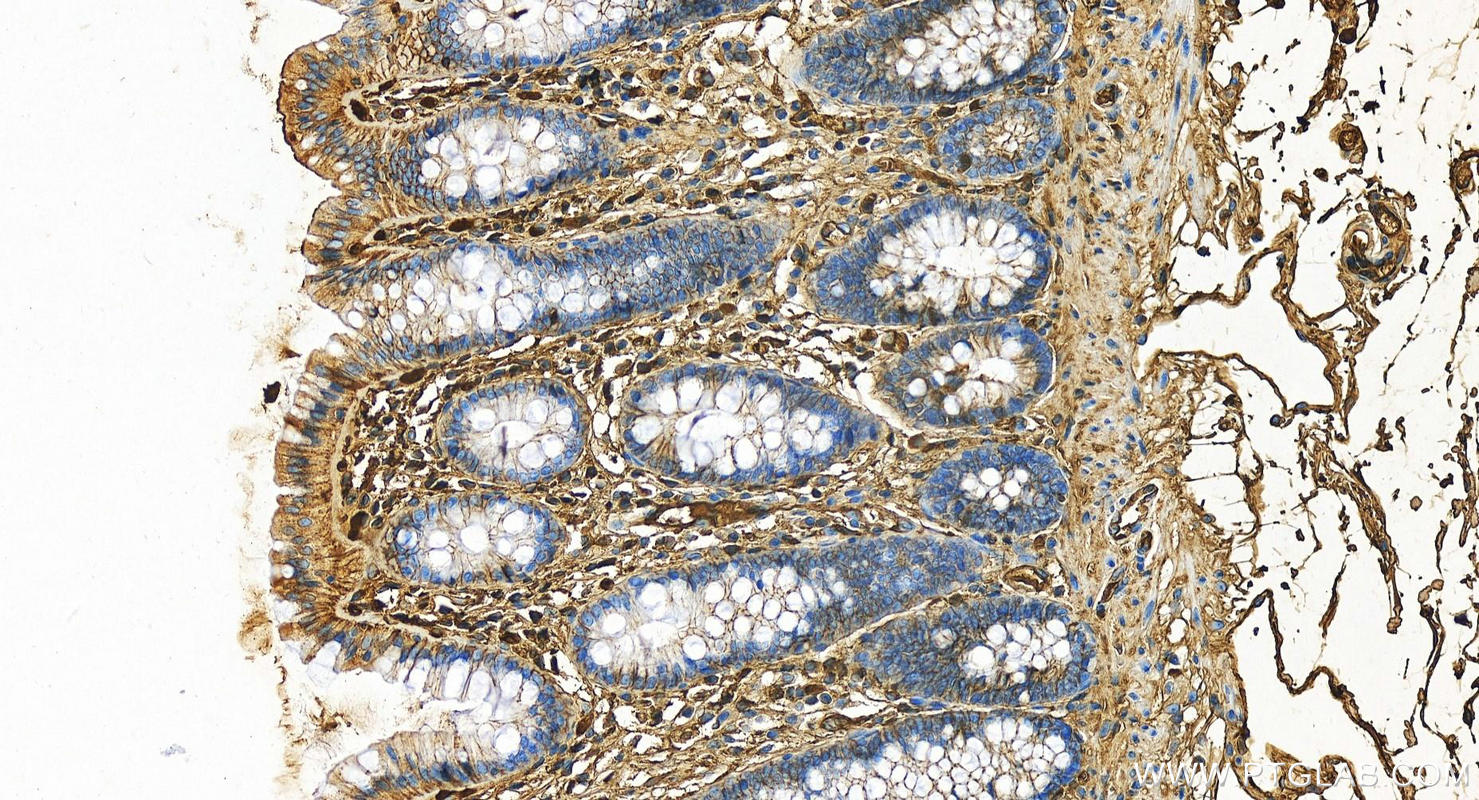 Immunohistochemistry (IHC) staining of human colon tissue using Albumin Polyclonal antibody (16475-1-AP)