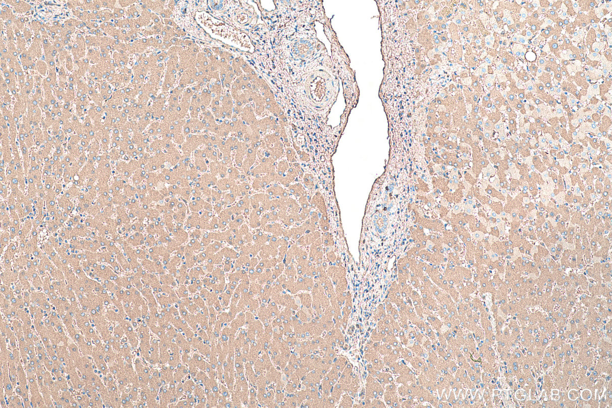 Immunohistochemistry (IHC) staining of human liver tissue using Albumin Monoclonal antibody (66051-1-Ig)