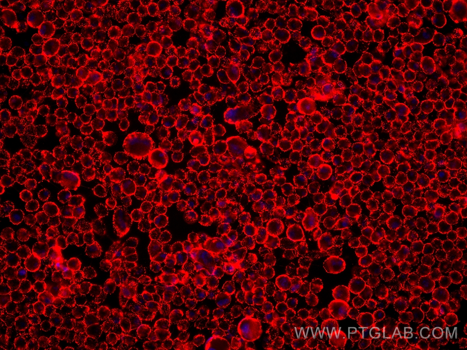 Immunofluorescence (IF) / fluorescent staining of hTERT-RPE1 cells using Anti-Human ALCAM (3A6) Mouse IgG2a Recombinant Ant (65611-1-MR)