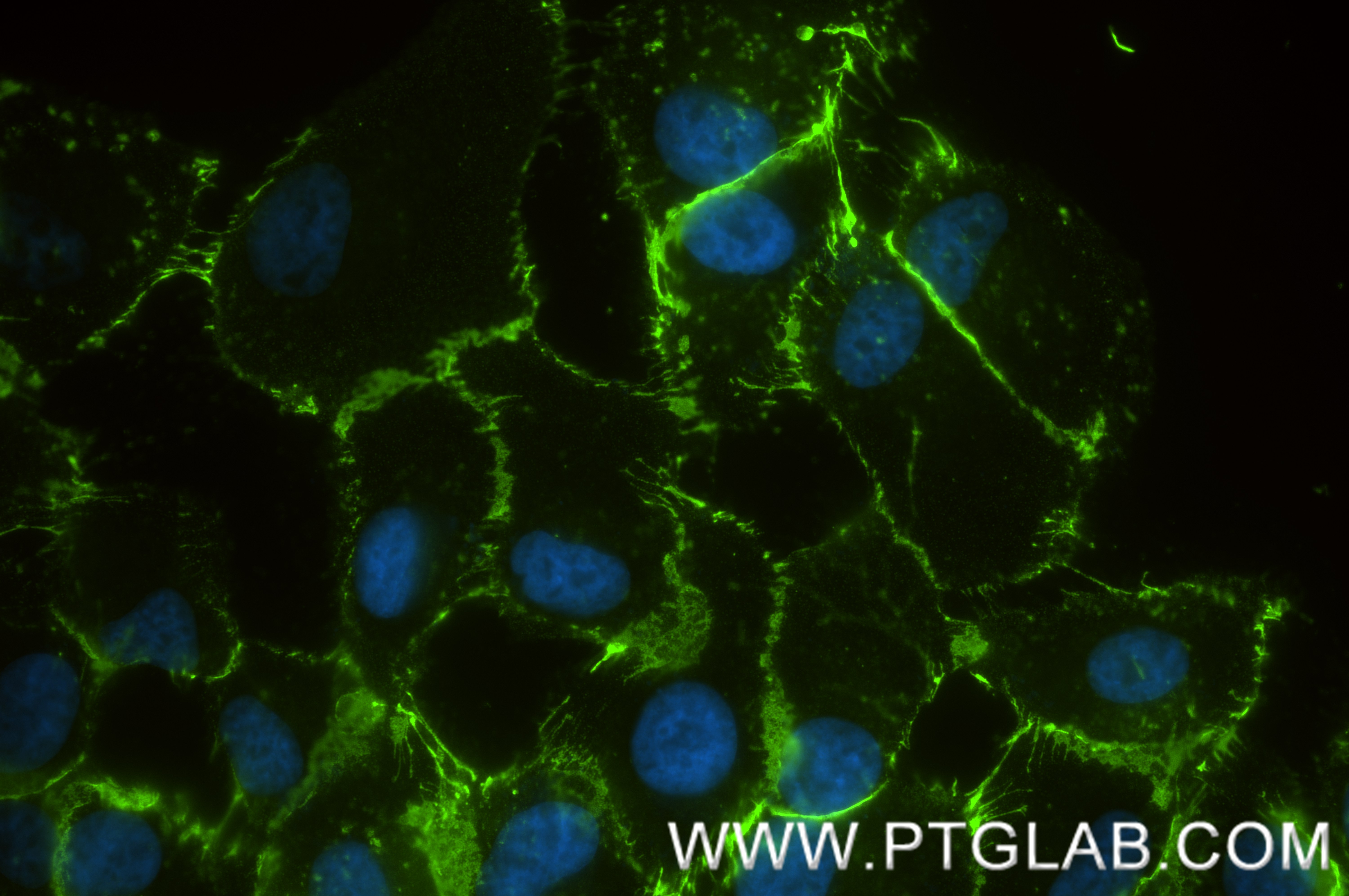 Immunofluorescence (IF) / fluorescent staining of hTERT-RPE1 cells using Anti-Human ALCAM (3A6) Mouse IgG2a Recombinant Ant (65611-1-MR)