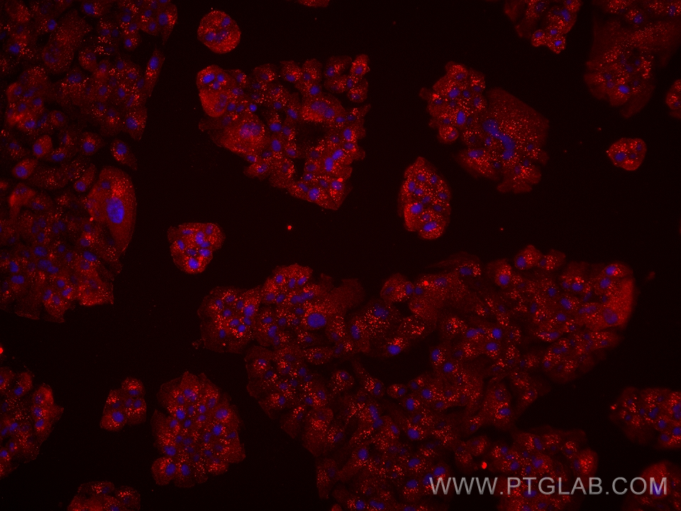 Immunofluorescence (IF) / fluorescent staining of hTERT-RPE1 cells using ALCAM Monoclonal antibody (67768-1-Ig)