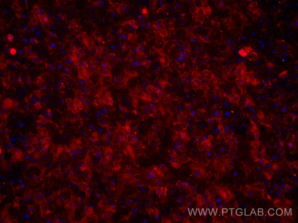 Immunofluorescence (IF) / fluorescent staining of hTERT-RPE1 cells using ALCAM Monoclonal antibody (67768-1-Ig)