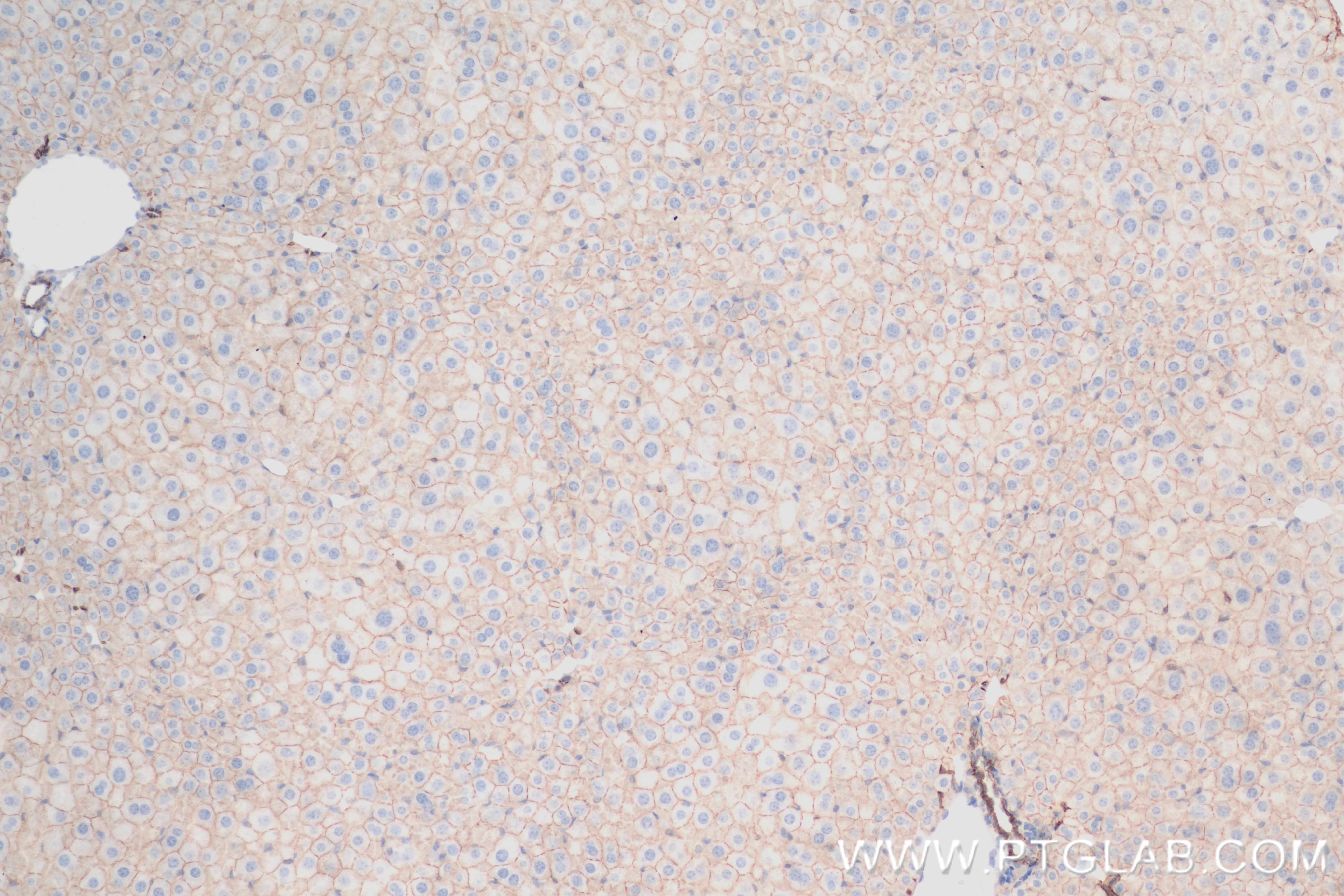 Immunohistochemistry (IHC) staining of mouse liver tissue using ALCAM Recombinant antibody (84528-1-RR)