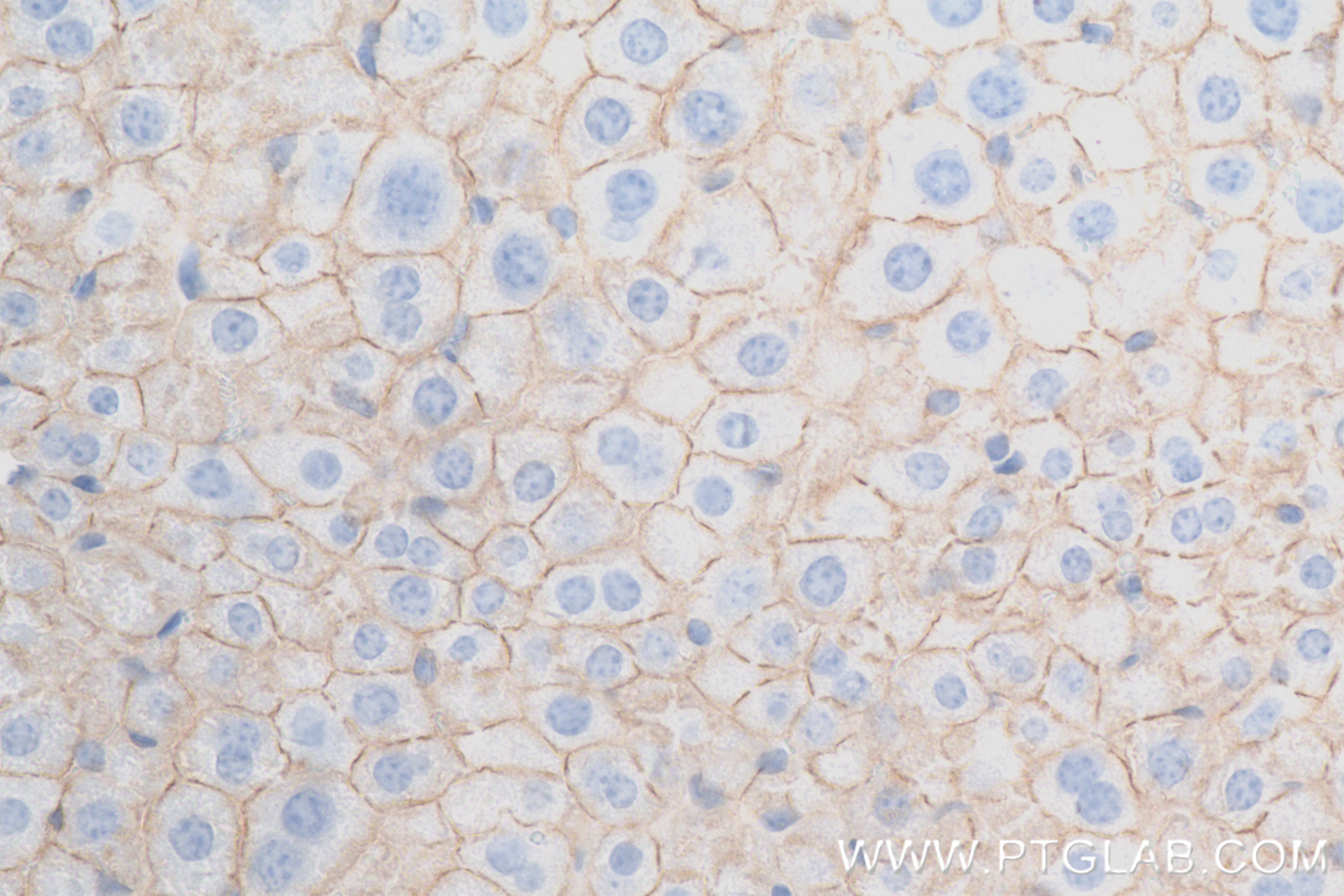 Immunohistochemistry (IHC) staining of mouse liver tissue using ALCAM Recombinant antibody (84528-1-RR)