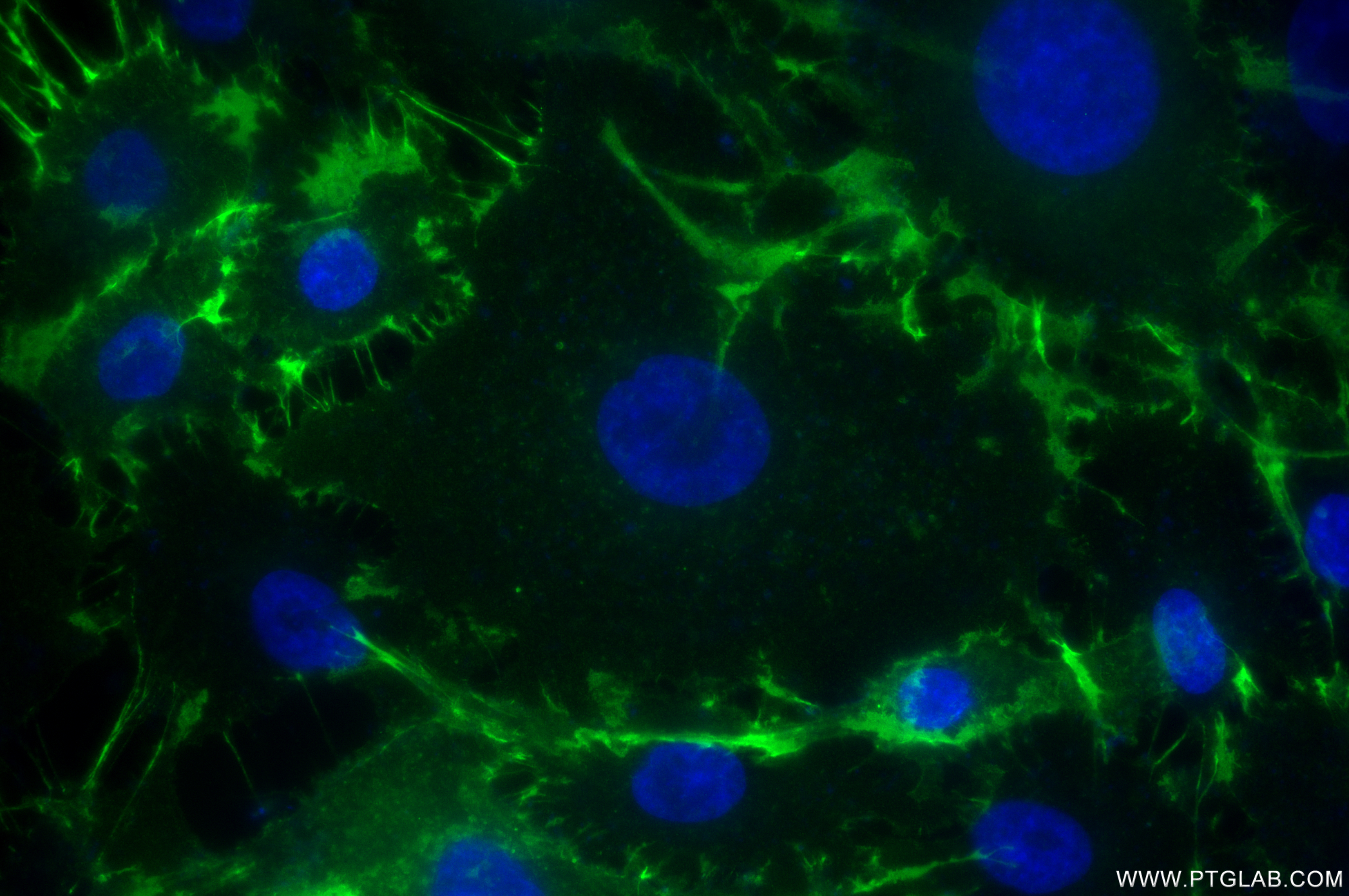 Immunofluorescence (IF) / fluorescent staining of A549 cells using ALCAM Recombinant monoclonal antibody (86811-1-RR)