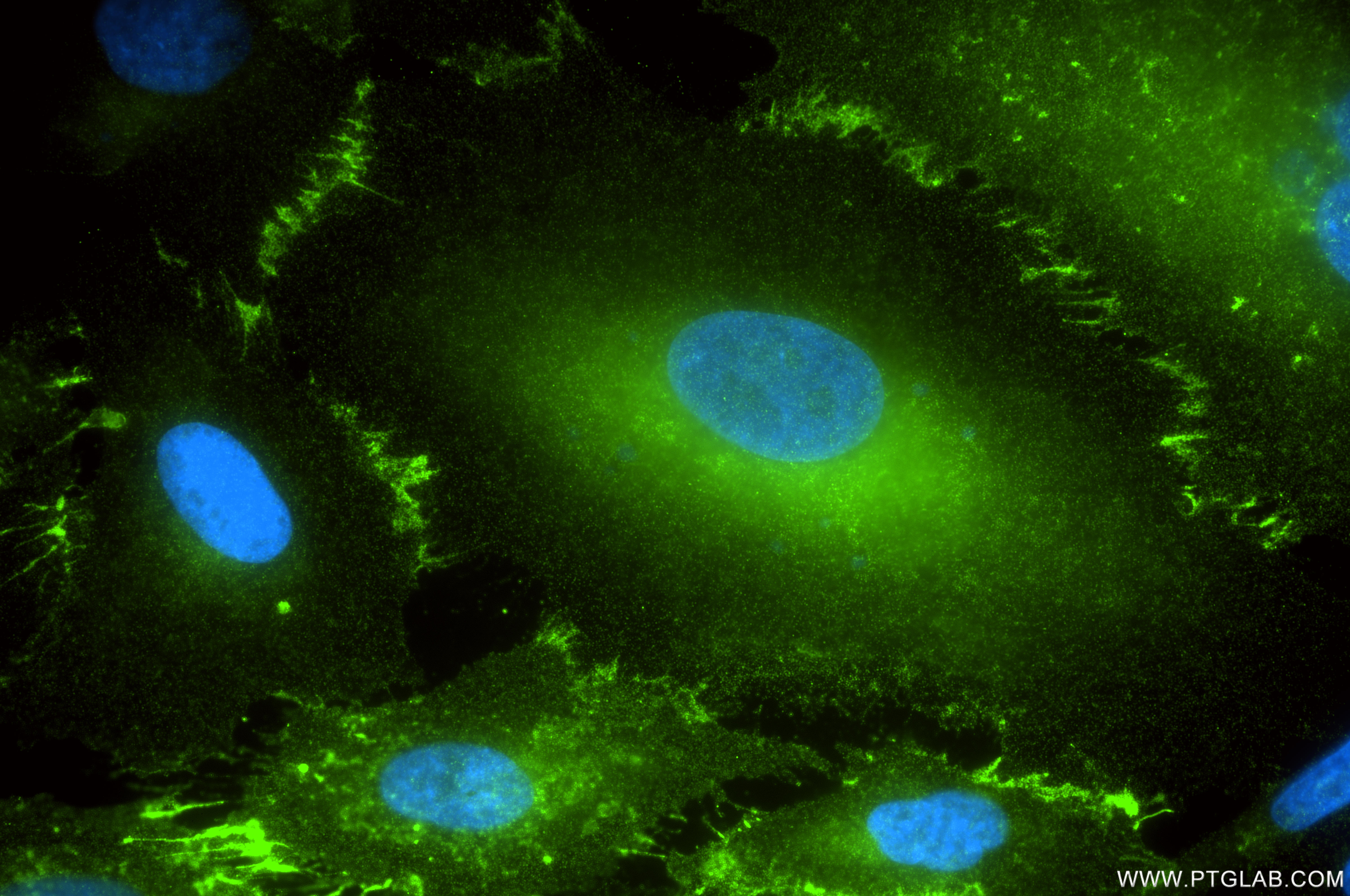 Immunofluorescence (IF) / fluorescent staining of A549 cells using ALCAM Recombinant monoclonal antibody (86811-3-RR)