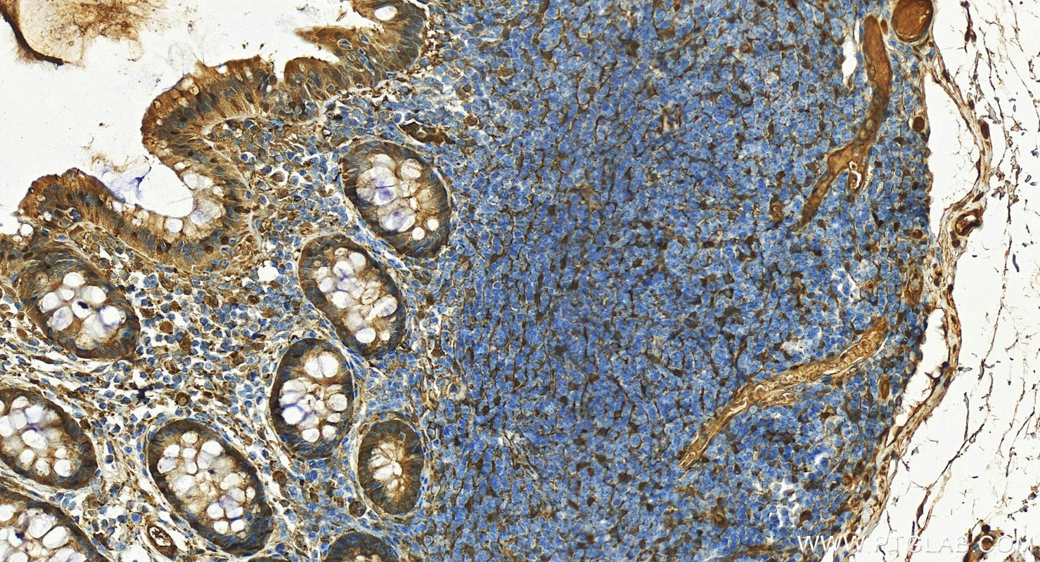 Immunohistochemistry (IHC) staining of human colon tissue using ALDH1A1 Polyclonal antibody (15910-1-AP)