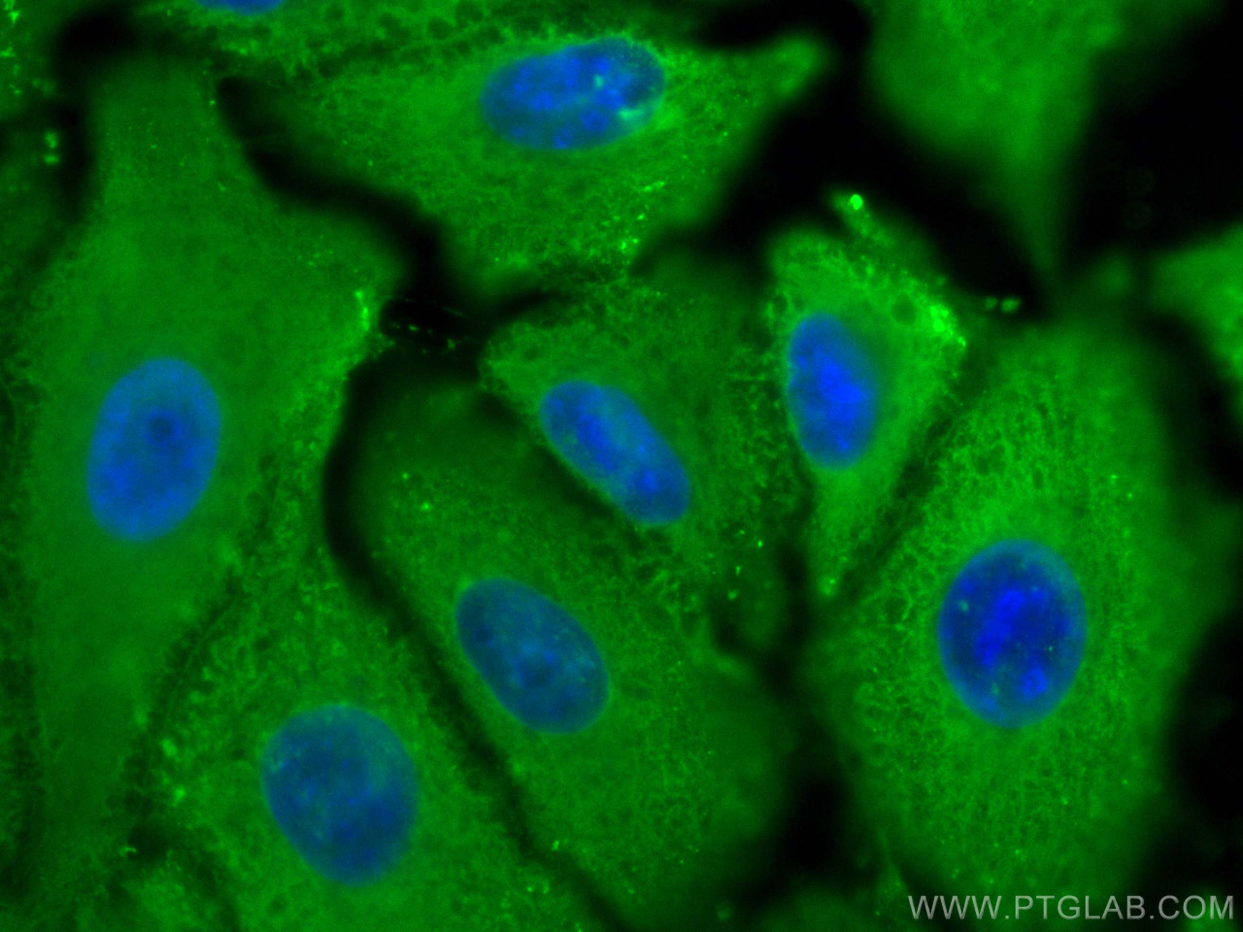 Immunofluorescence (IF) / fluorescent staining of A549 cells using ALDH1A1 Polyclonal antibody (15910-1-AP)