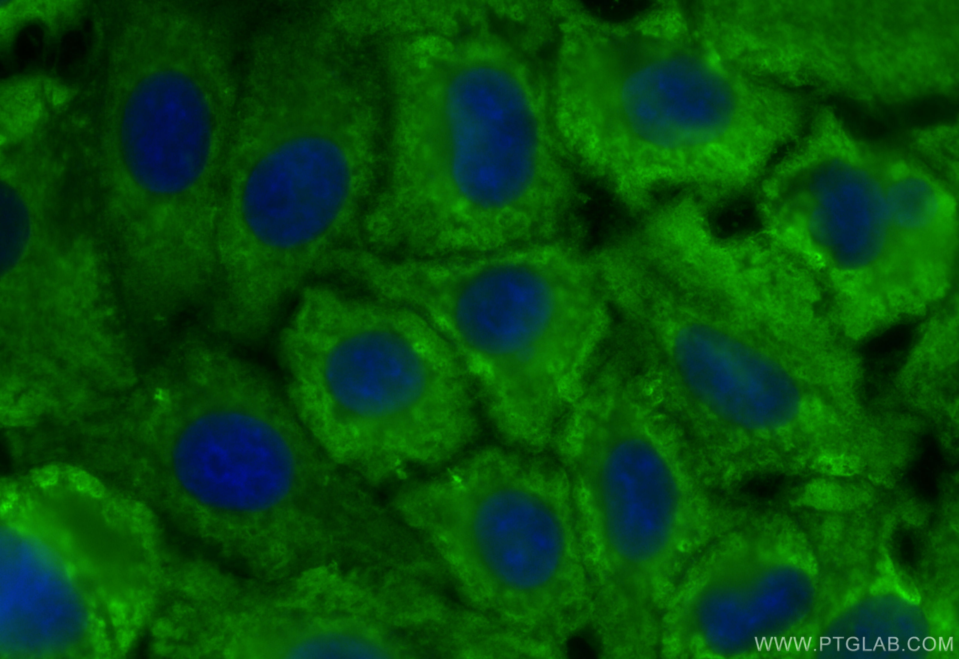 Immunofluorescence (IF) / fluorescent staining of A549 cells using ALDH1A1 Polyclonal antibody (15910-1-AP)