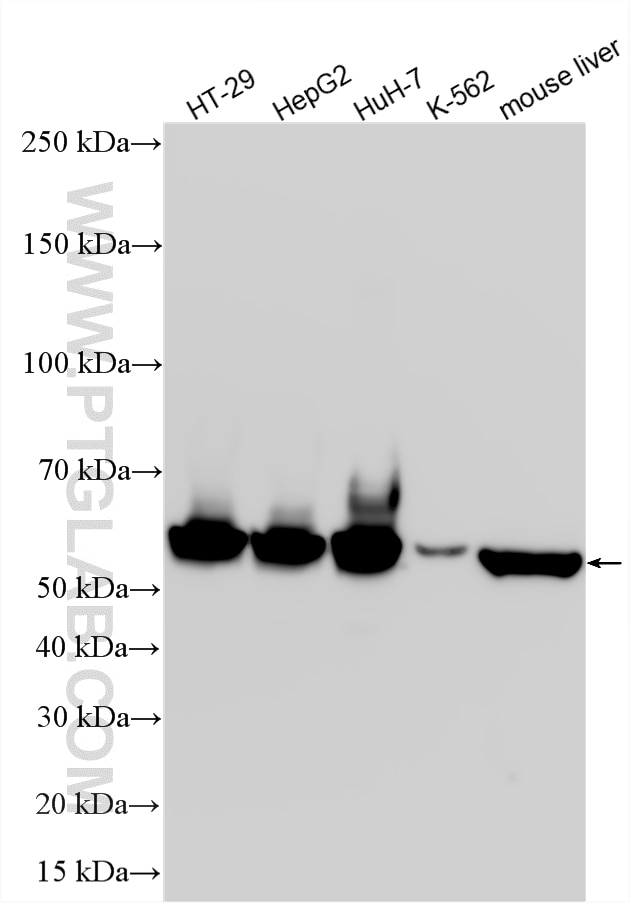 Western Blot (WB) analysis of various lysates using ALDH1A1 Polyclonal antibody (15910-1-AP)