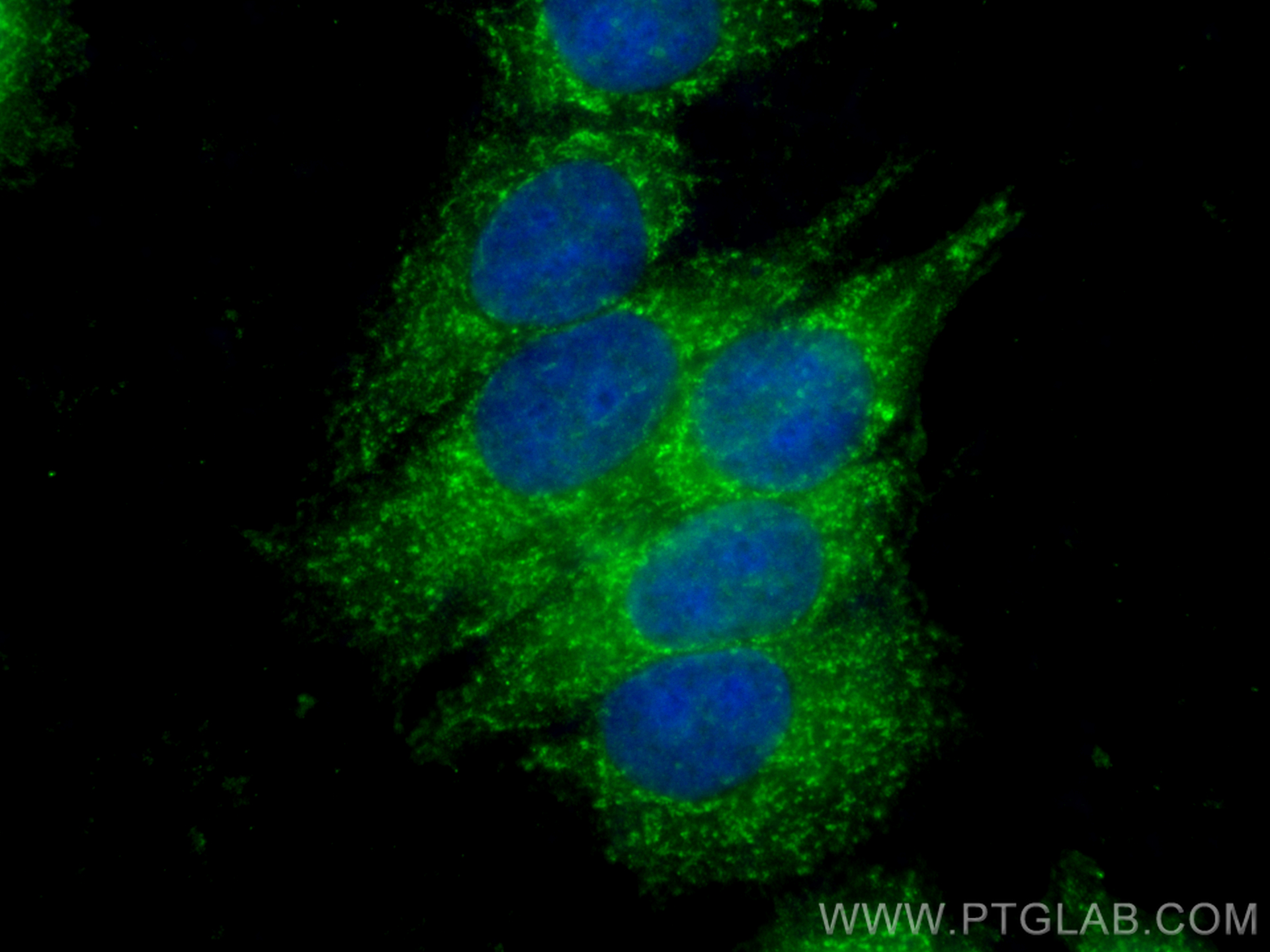 Immunofluorescence (IF) / fluorescent staining of MCF-7 cells using ALDH1B1 Polyclonal antibody (22220-1-AP)