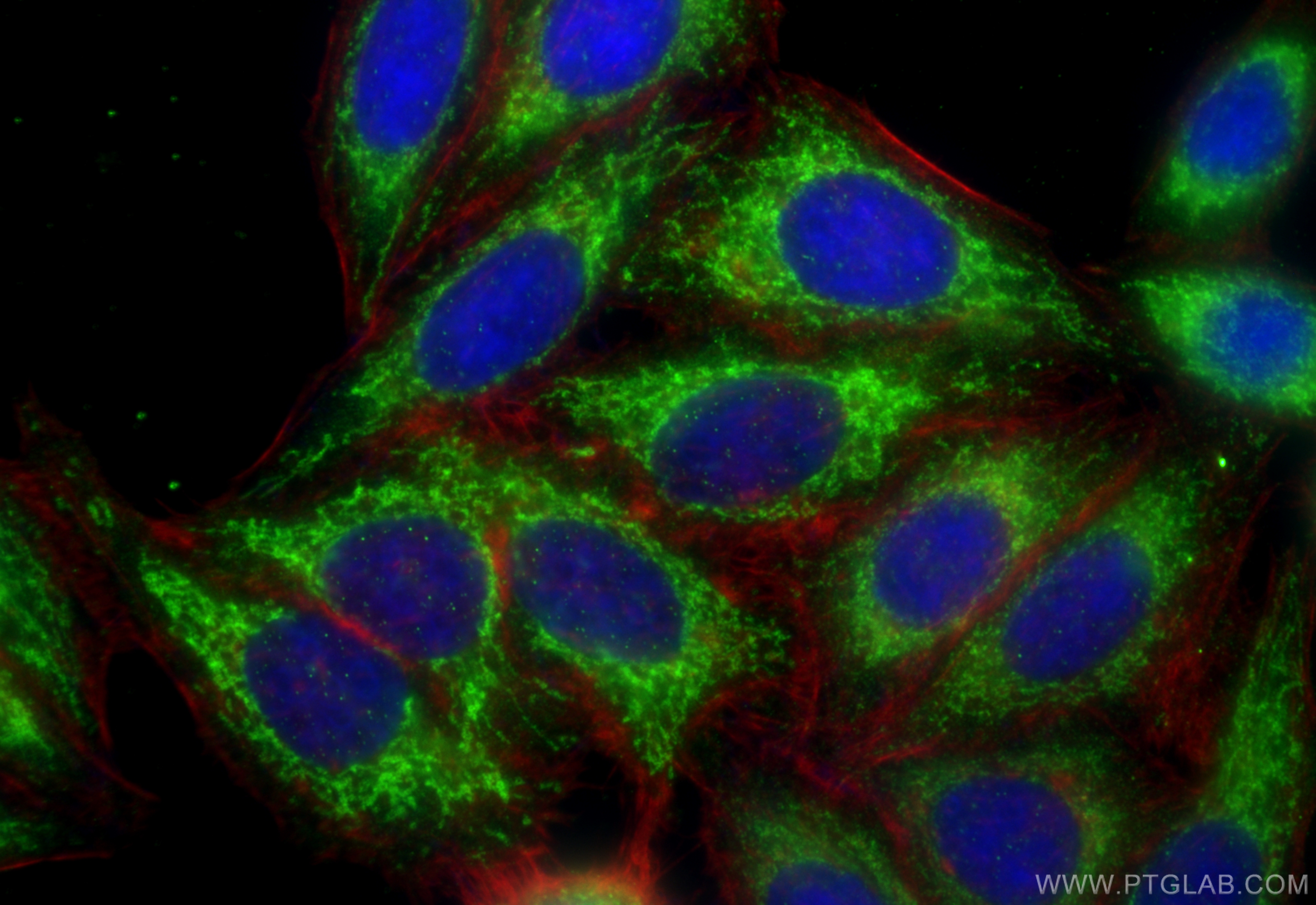 Immunofluorescence (IF) / fluorescent staining of HepG2 cells using ALDH1B1 Polyclonal antibody (22220-1-AP)