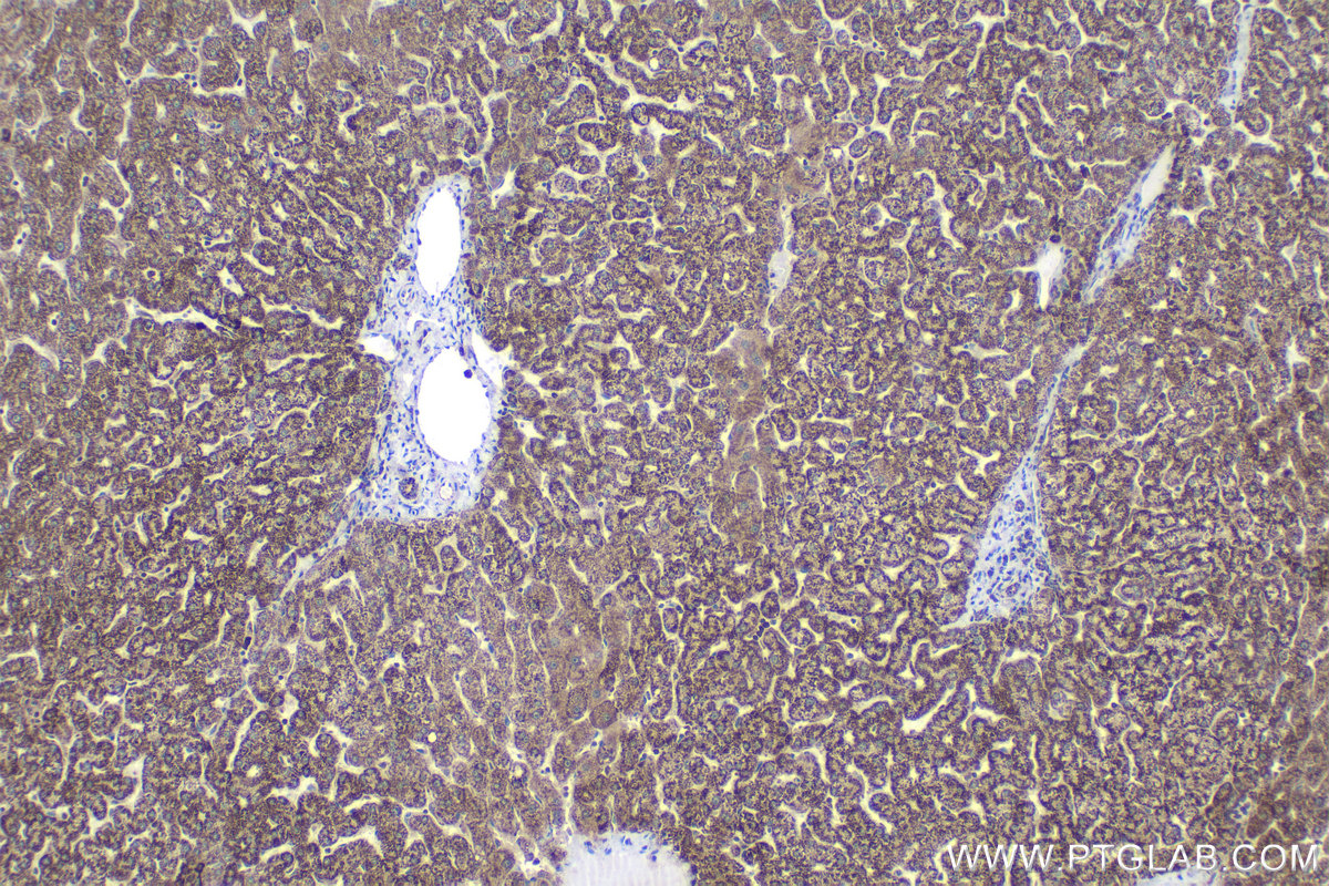 Immunohistochemistry (IHC) staining of human liver tissue using ALDH1B1 Polyclonal antibody (22220-1-AP)