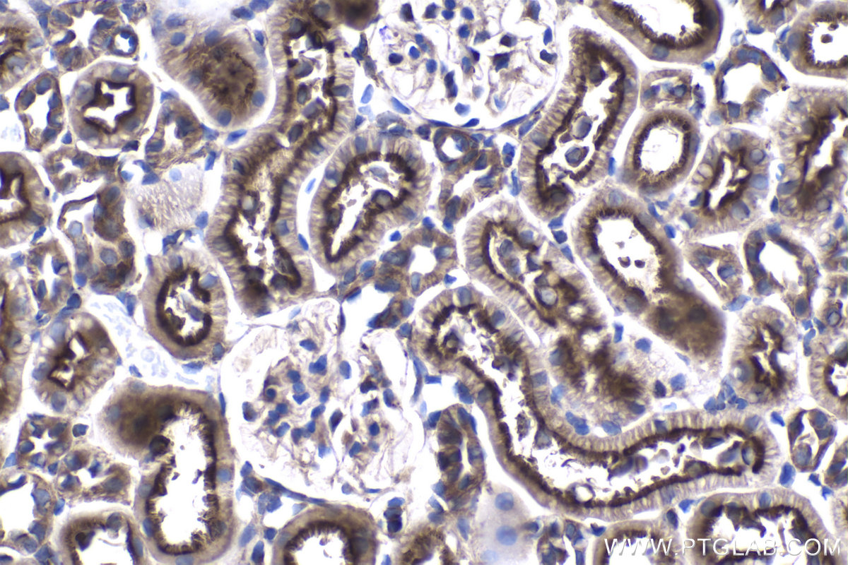 Immunohistochemistry (IHC) staining of rat kidney tissue using ALDH1B1 Polyclonal antibody (22220-1-AP)