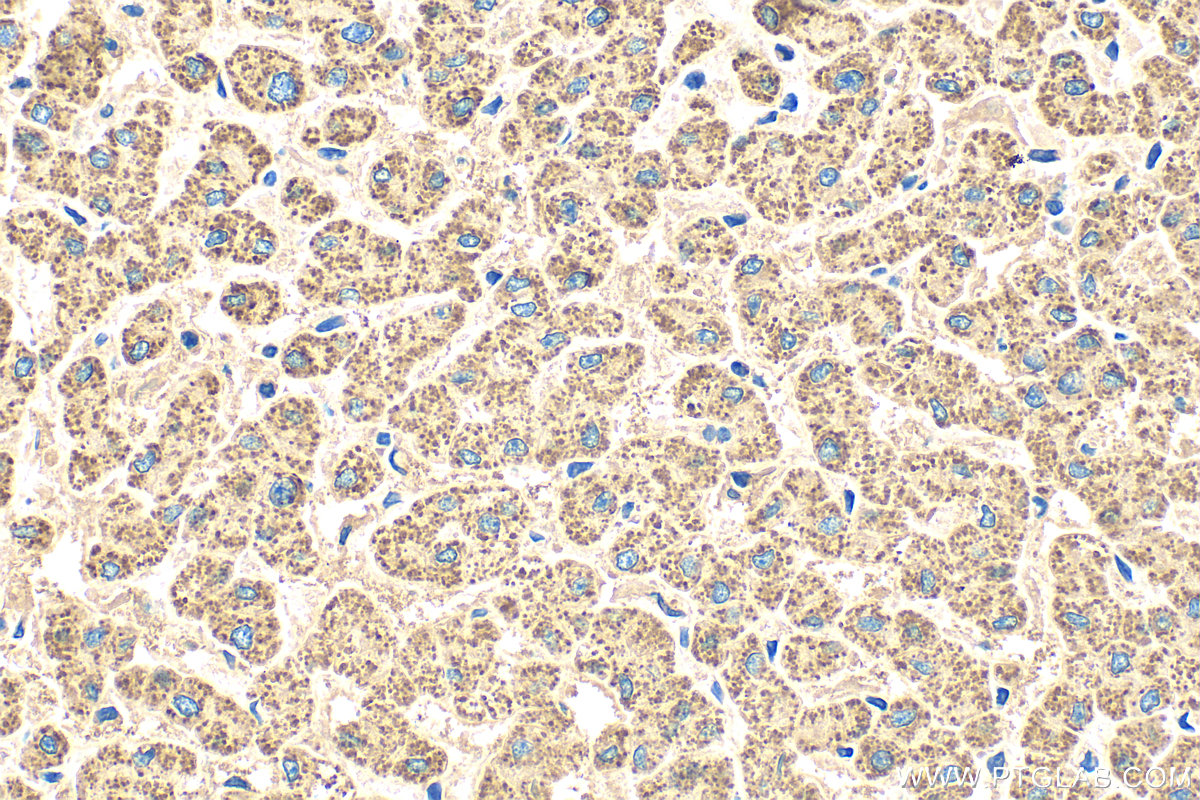 Immunohistochemistry (IHC) staining of human liver tissue using ALDH1B1 Polyclonal antibody (22220-1-AP)