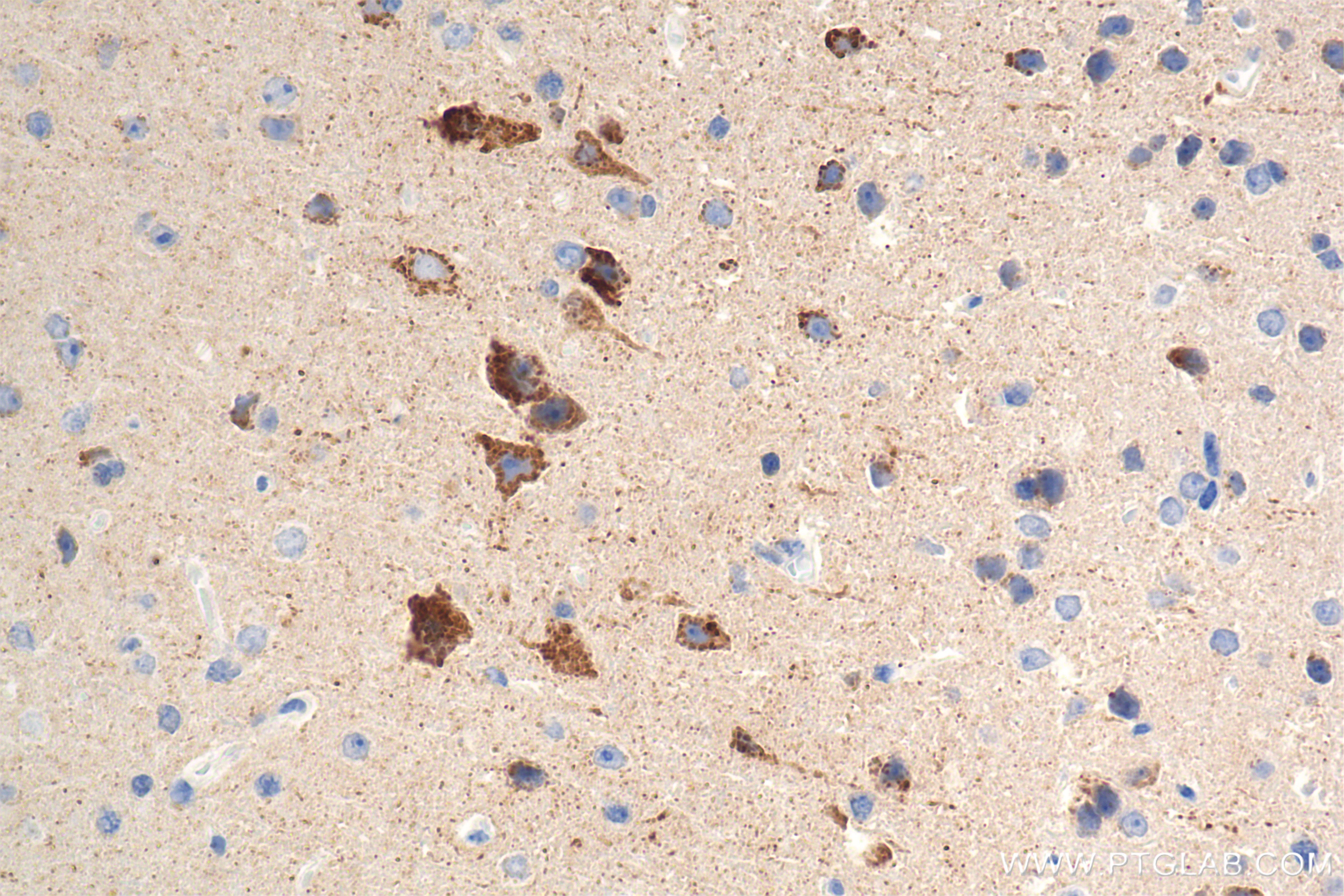 Immunohistochemistry (IHC) staining of mouse brain tissue using ALDH1B1 Recombinant monoclonal antibody (85426-2-RR)