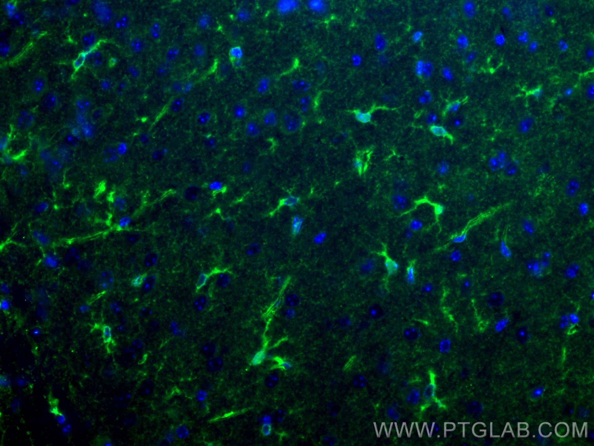 Immunofluorescence (IF) / fluorescent staining of mouse brain tissue using CoraLite® Plus 488-conjugated ALDH1L1 Polyclonal a (CL488-17390)