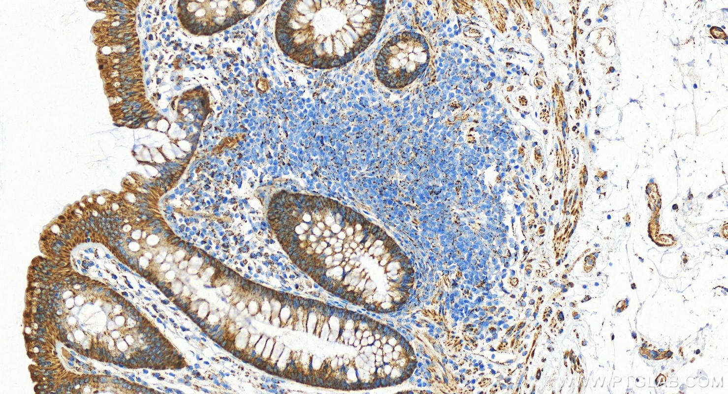 Immunohistochemistry (IHC) staining of human colon tissue using ALDH2 Polyclonal antibody (15310-1-AP)