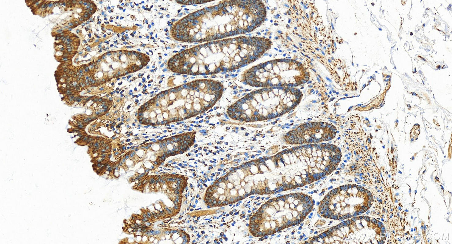 Immunohistochemistry (IHC) staining of human colon tissue using ALDH2 Polyclonal antibody (15310-1-AP)