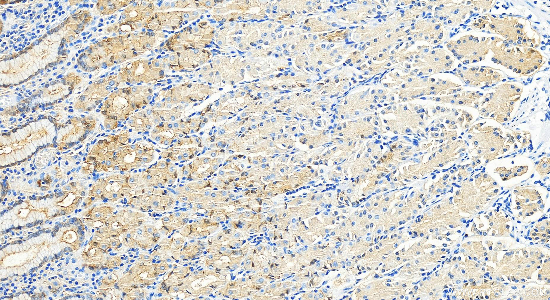 Immunohistochemistry (IHC) staining of human stomach tissue using ALDH3A1 Polyclonal antibody (15578-1-AP)