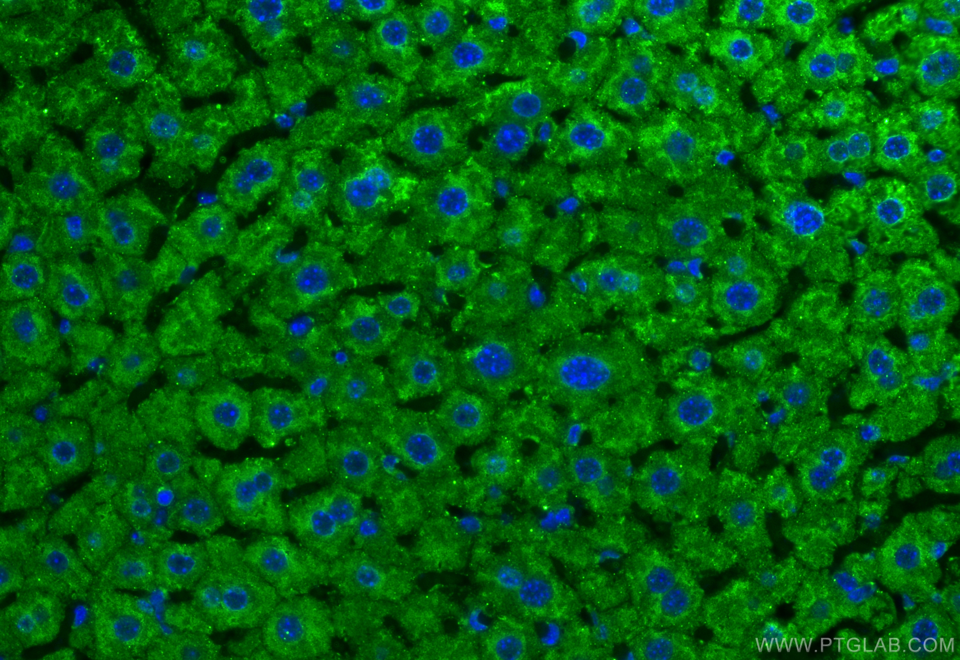 Immunofluorescence (IF) / fluorescent staining of mouse liver tissue using ALDH5A1 Monoclonal antibody (67347-1-Ig)