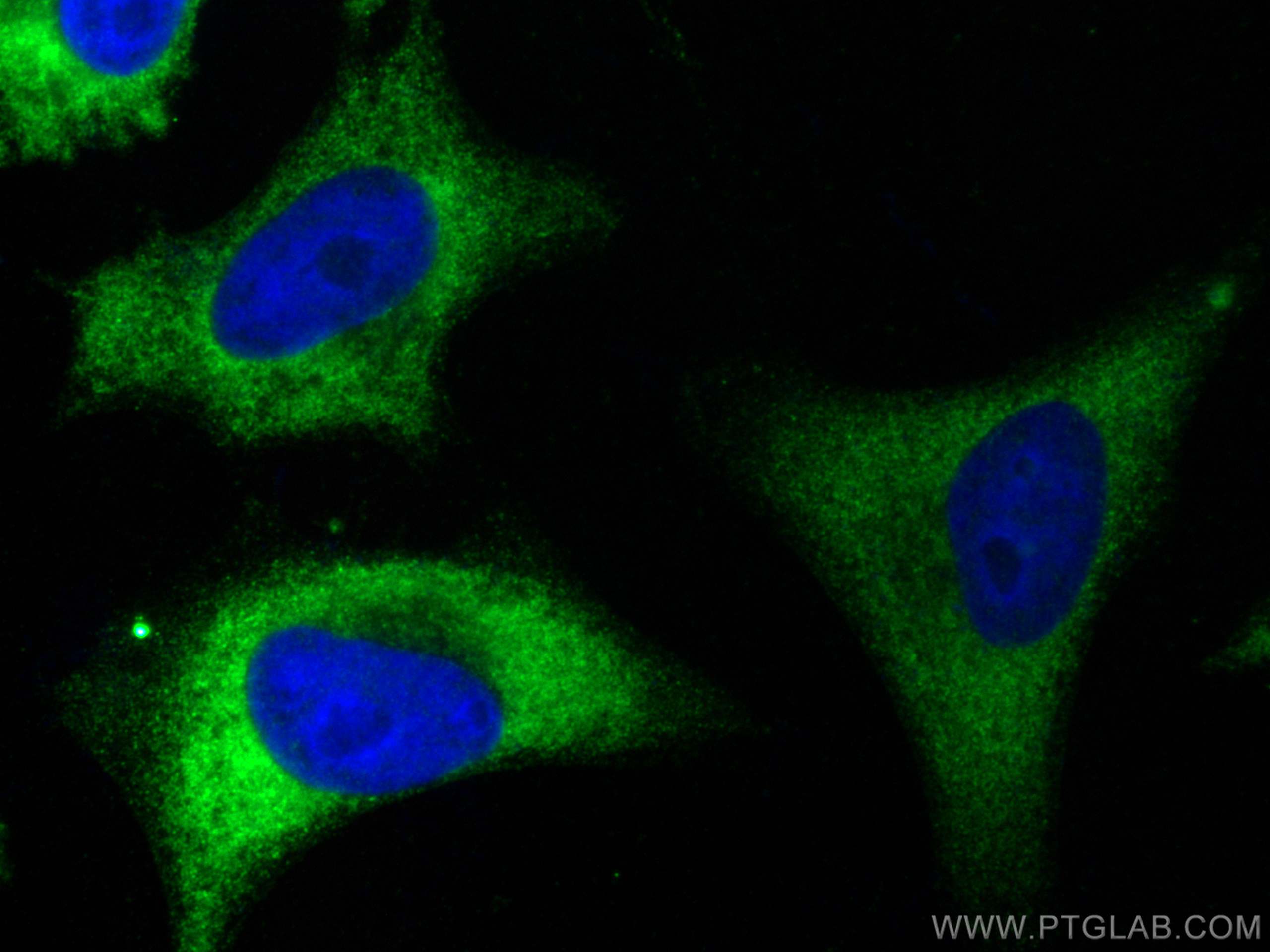 Immunofluorescence (IF) / fluorescent staining of HeLa cells using ALDH9A1 Polyclonal antibody (26621-1-AP)