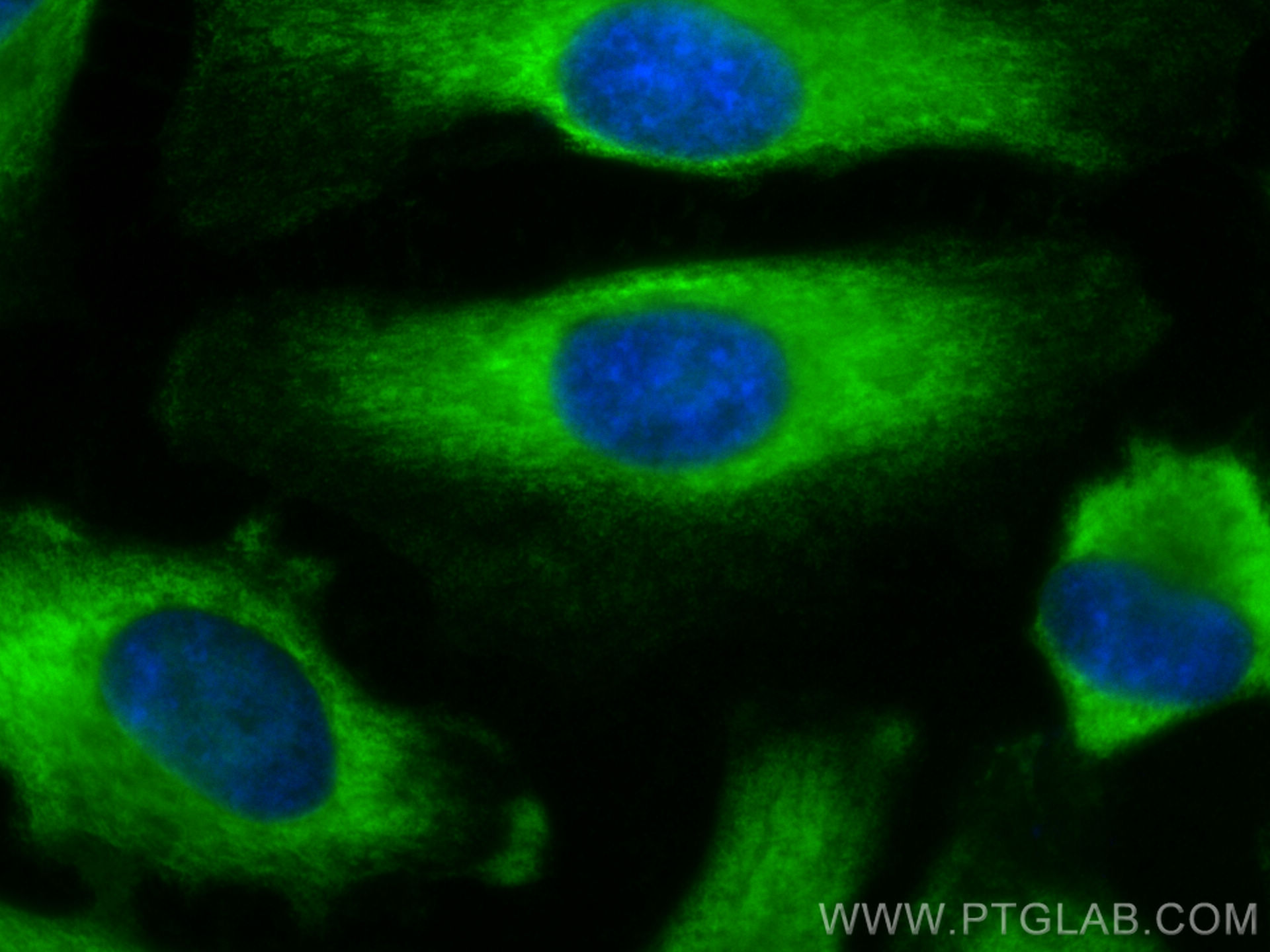 Immunofluorescence (IF) / fluorescent staining of HeLa cells using ALDOA Polyclonal antibody (11217-1-AP)