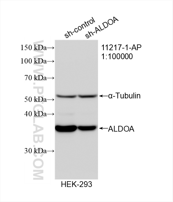 Western Blot (WB) analysis of HEK-293 cells using ALDOA Polyclonal antibody (11217-1-AP)