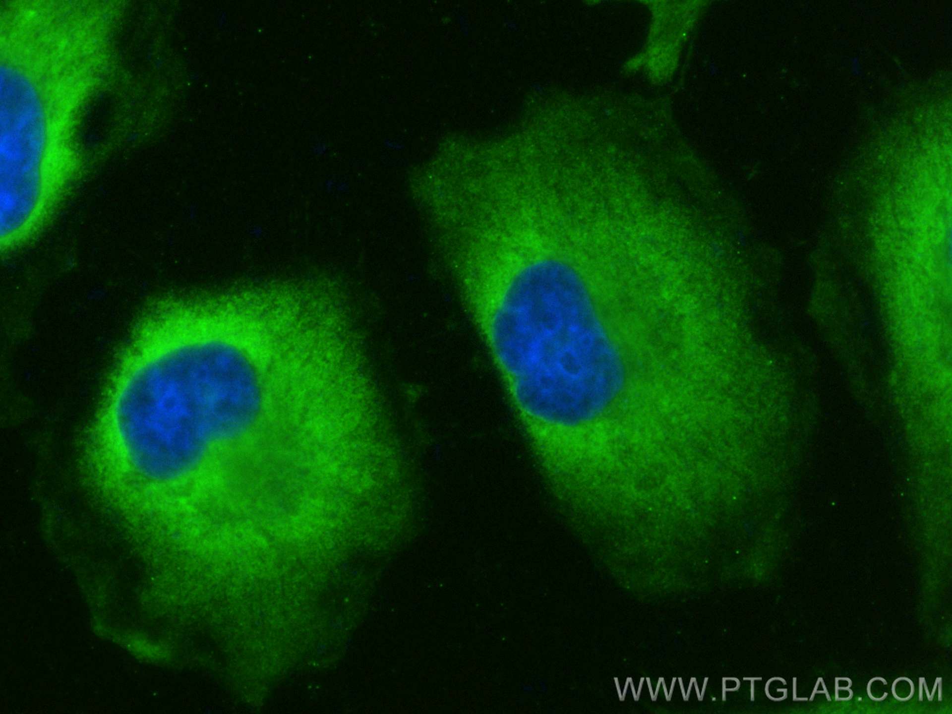 Immunofluorescence (IF) / fluorescent staining of HeLa cells using ALDOA Monoclonal antibody (67453-1-Ig)