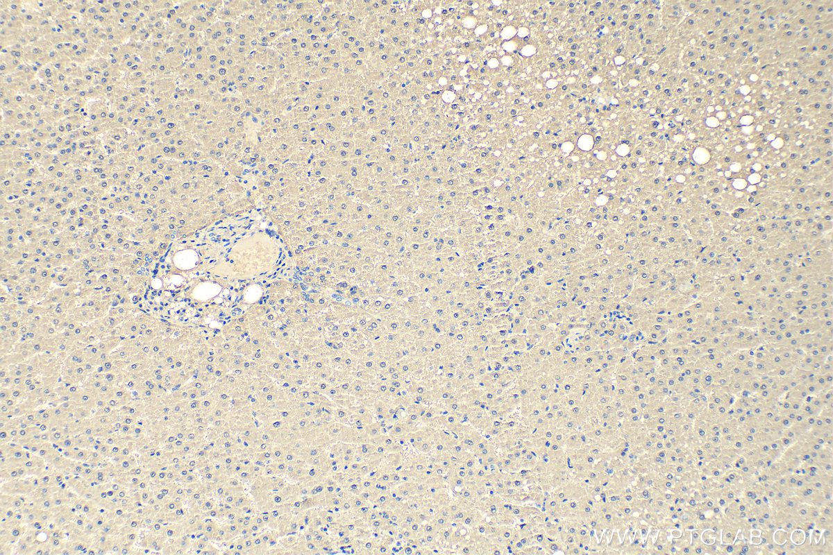 Immunohistochemistry (IHC) staining of human liver tissue using ALDOB Polyclonal antibody (18065-1-AP)