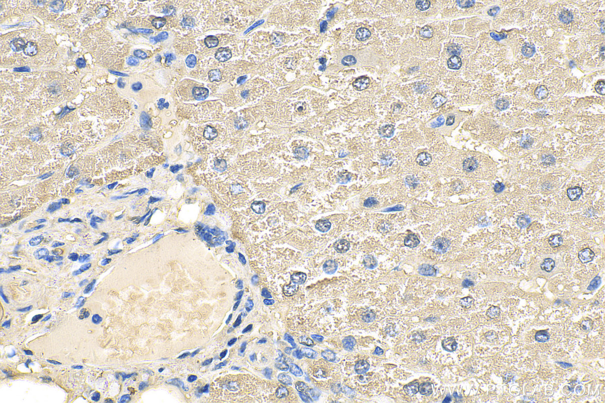 Immunohistochemistry (IHC) staining of human liver tissue using ALDOB Polyclonal antibody (18065-1-AP)