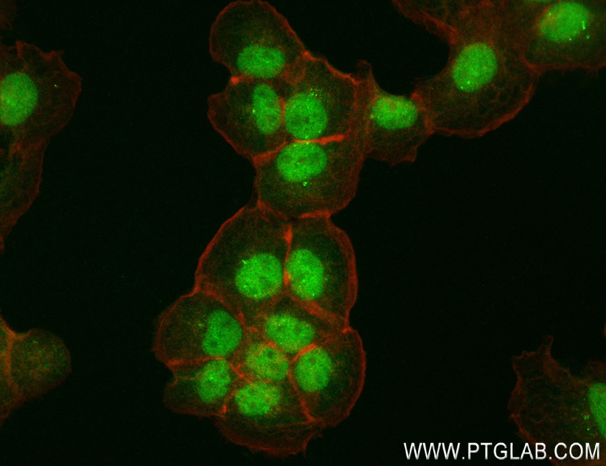 Immunofluorescence (IF) / fluorescent staining of A431 cells using ALKBH3 Recombinant antibody (84314-3-RR)