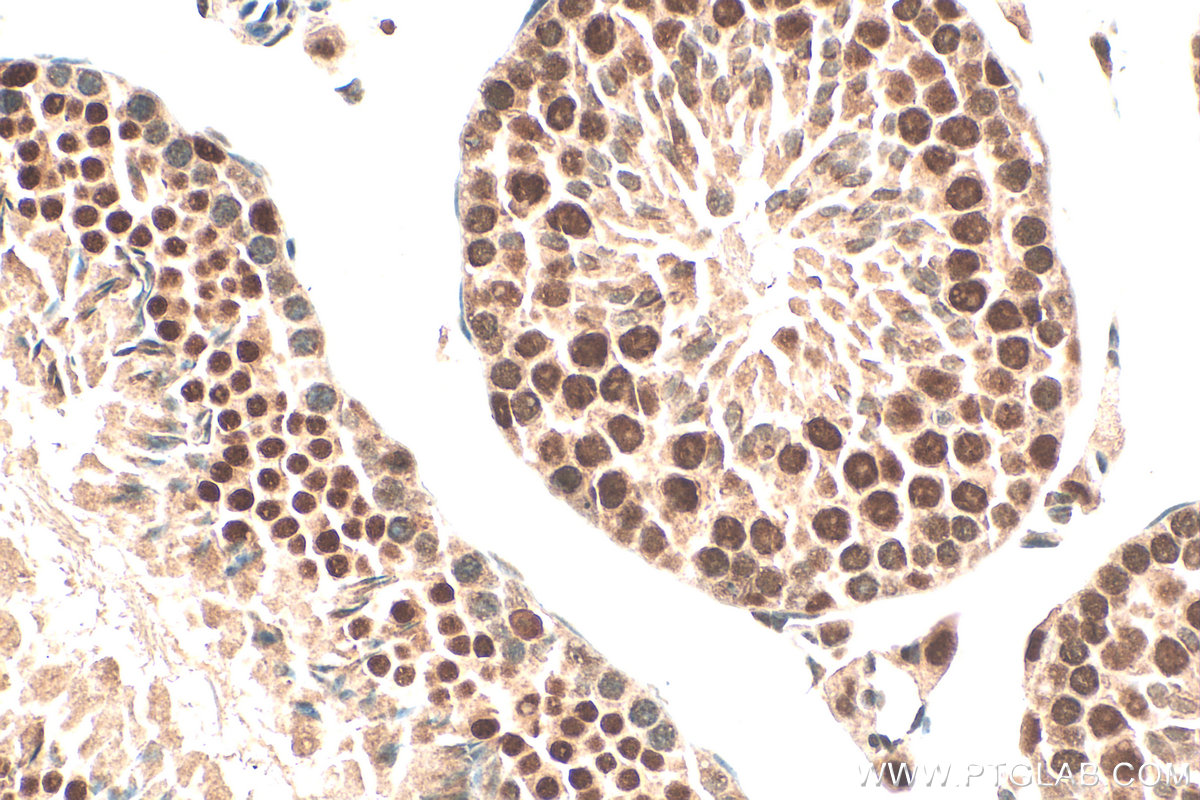 Immunohistochemistry (IHC) staining of mouse testis tissue using ALKBH5 Polyclonal antibody (16837-1-AP)