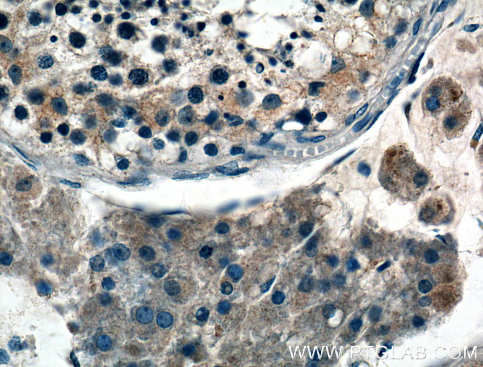 Immunohistochemistry (IHC) staining of human testis tissue using ALKBH6 Polyclonal antibody (21464-1-AP)