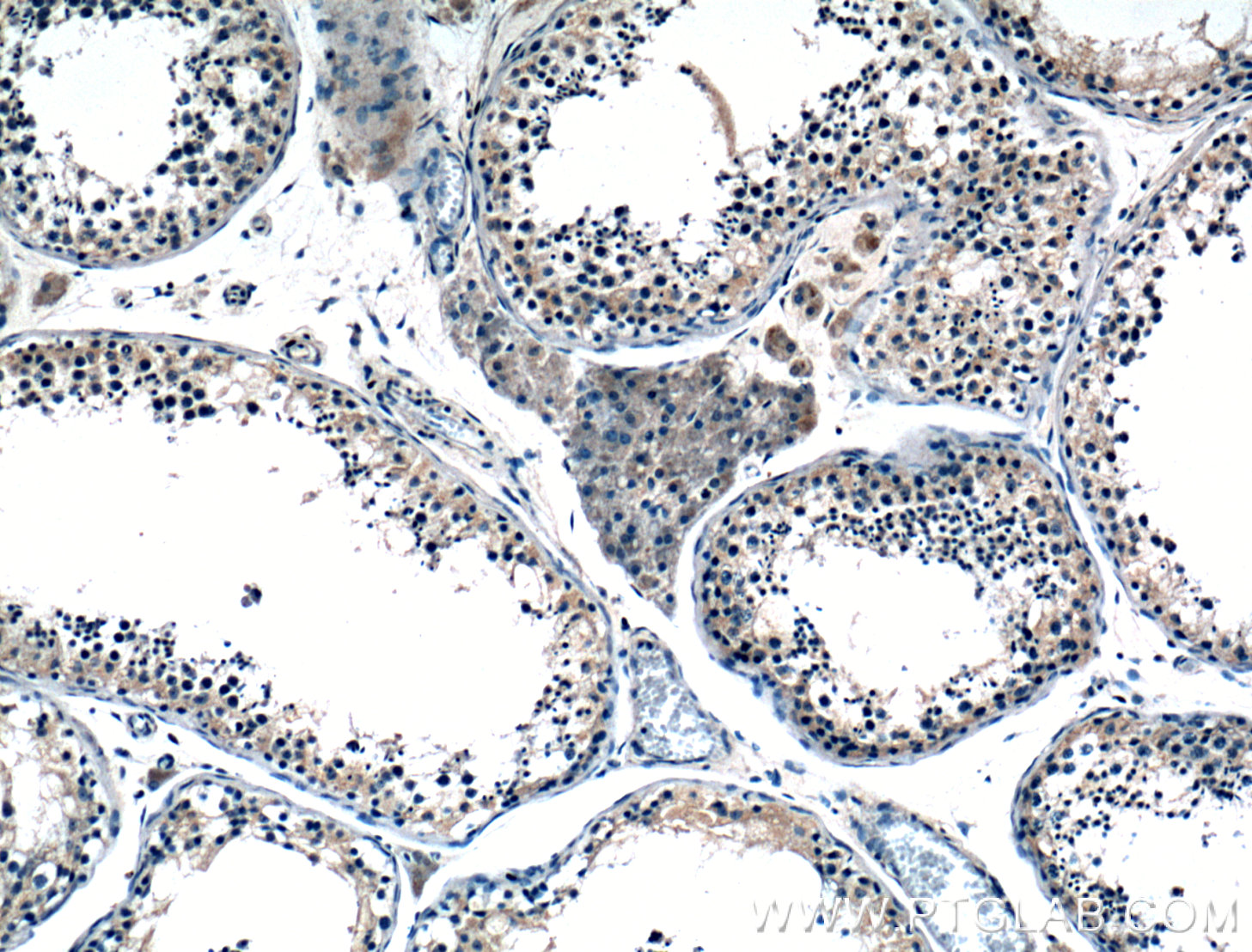 Immunohistochemistry (IHC) staining of human testis tissue using ALKBH6 Polyclonal antibody (21464-1-AP)