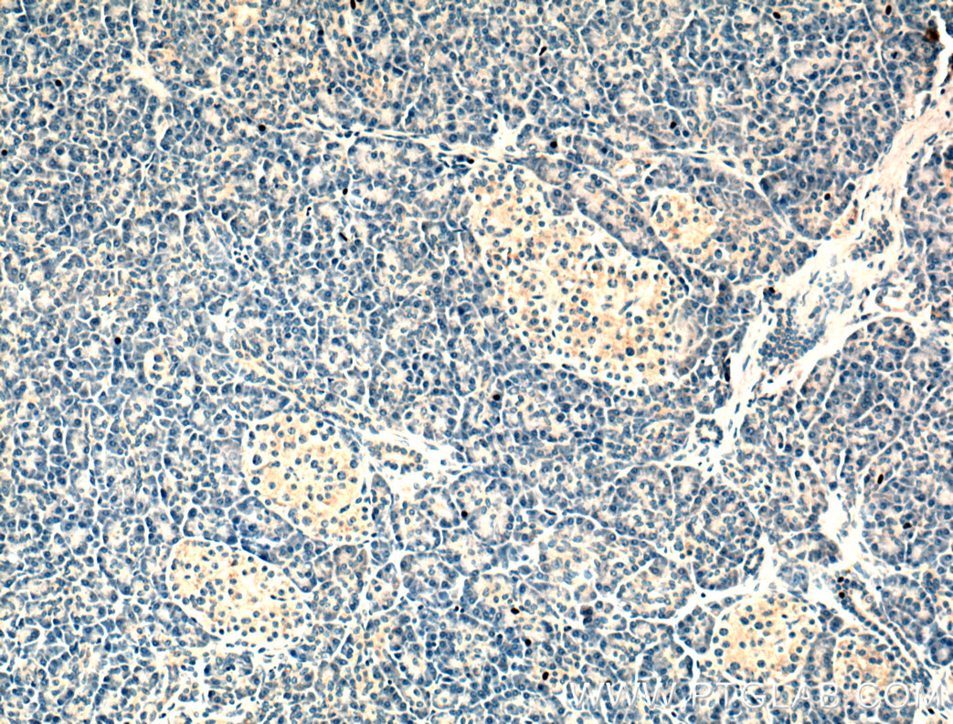 Immunohistochemistry (IHC) staining of human pancreas tissue using ALKBH6 Polyclonal antibody (21464-1-AP)