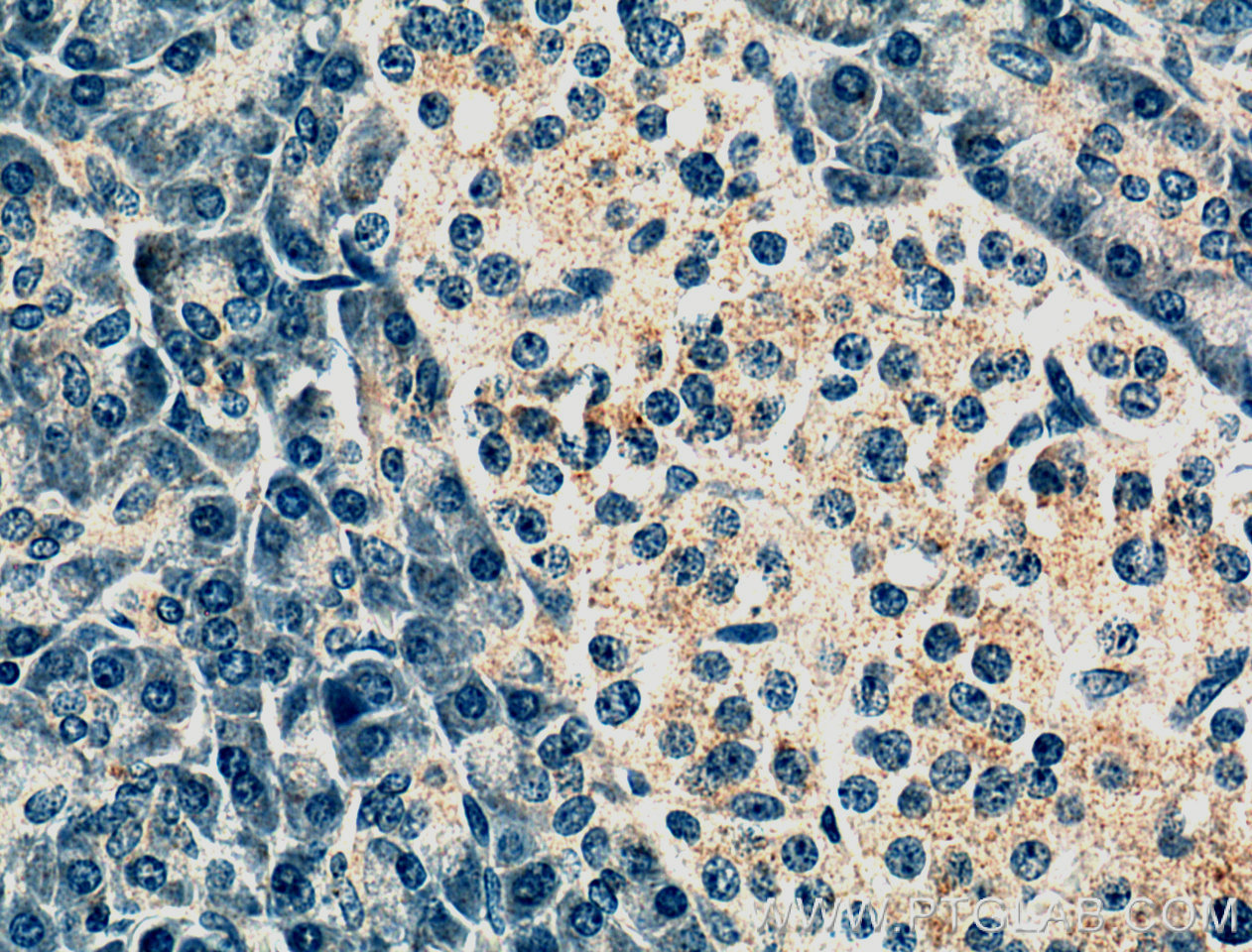 Immunohistochemistry (IHC) staining of human pancreas tissue using ALKBH6 Polyclonal antibody (21464-1-AP)