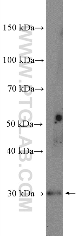 Western Blot (WB) analysis of mouse pancreas tissue using ALKBH6 Polyclonal antibody (21464-1-AP)