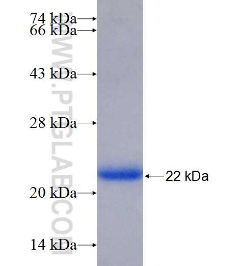 ALMS1 fusion protein Ag26113 SDS-PAGE