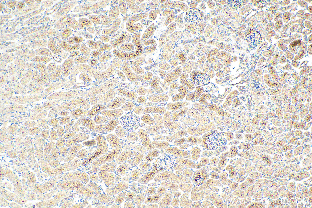 Immunohistochemistry (IHC) staining of mouse kidney tissue using ALPL Polyclonal antibody (11187-1-AP)