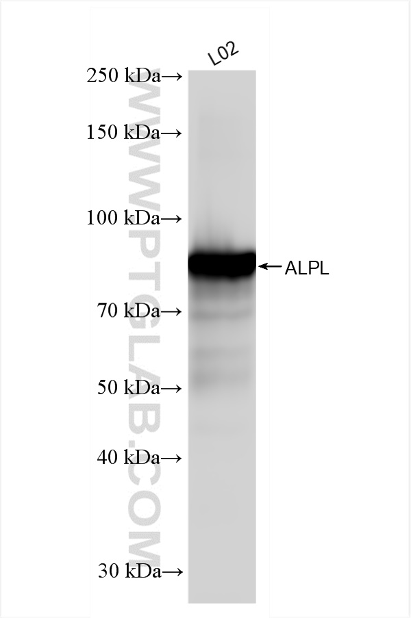 Western Blot (WB) analysis of L02 cells using ALPL Recombinant antibody (82915-2-RR)
