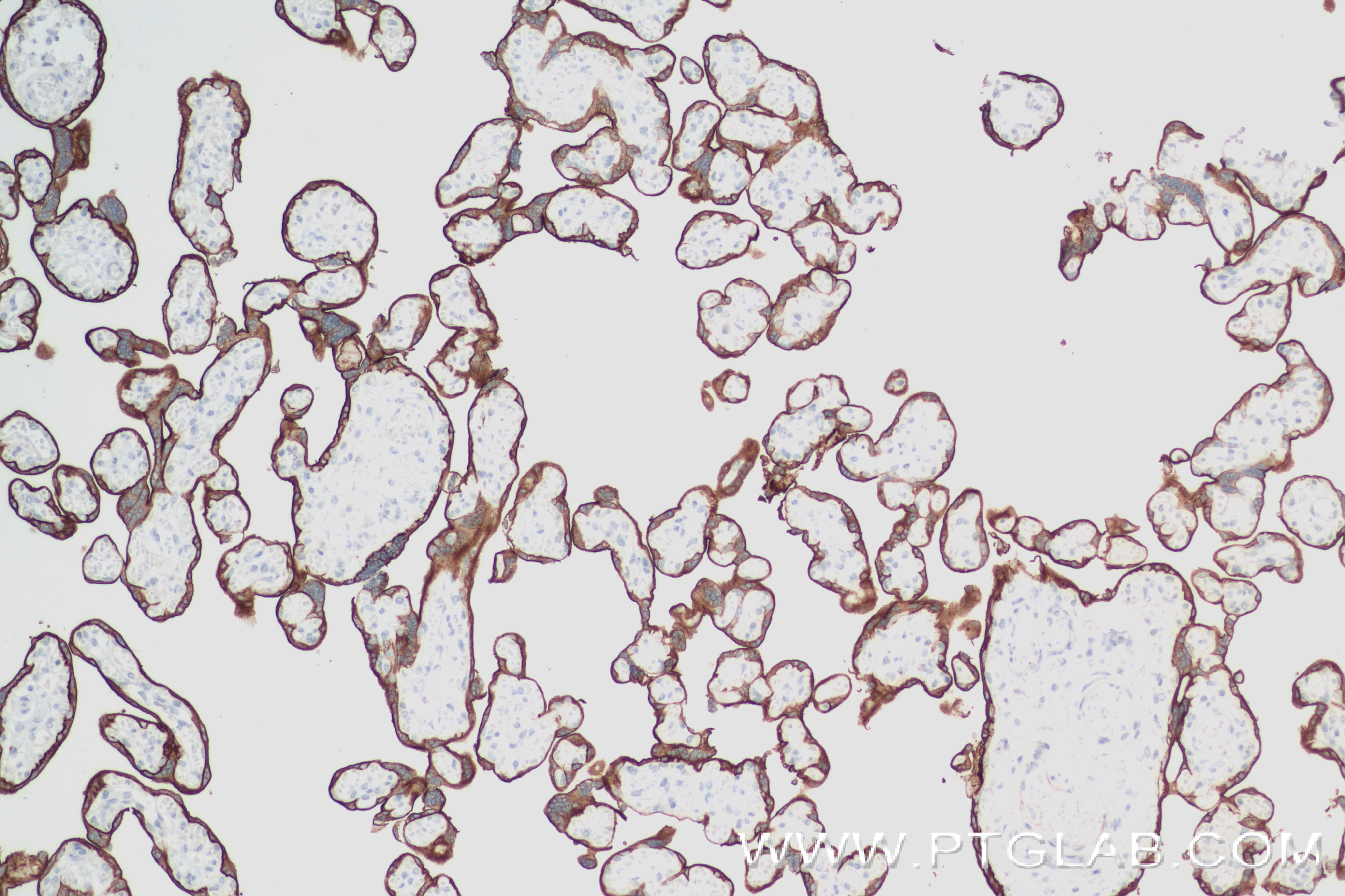 Immunohistochemistry (IHC) staining of human placenta tissue using ALPPL2 Recombinant antibody (84813-1-RR)