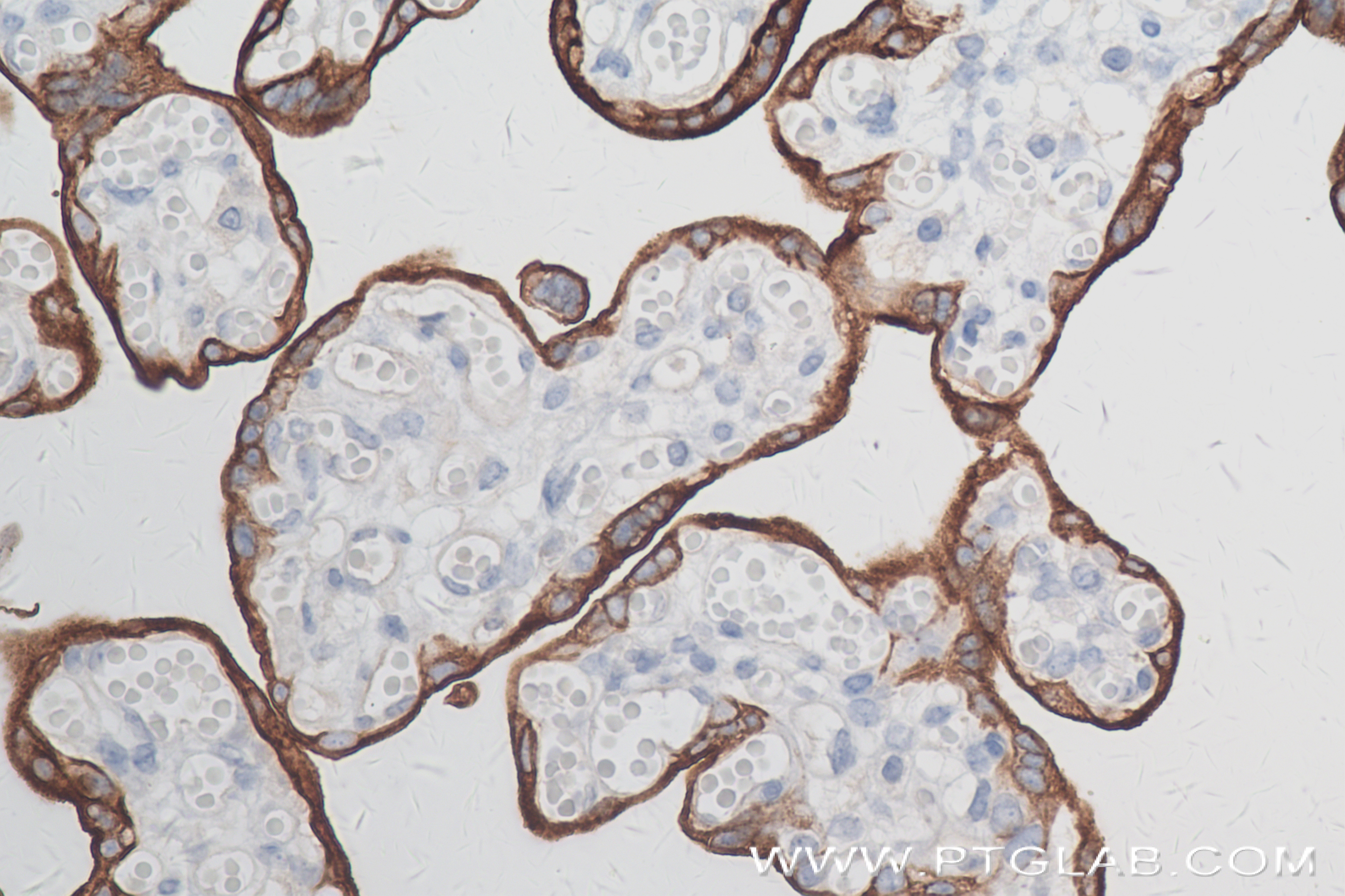 Immunohistochemistry (IHC) staining of human placenta tissue using ALPPL2 Recombinant antibody (84813-1-RR)